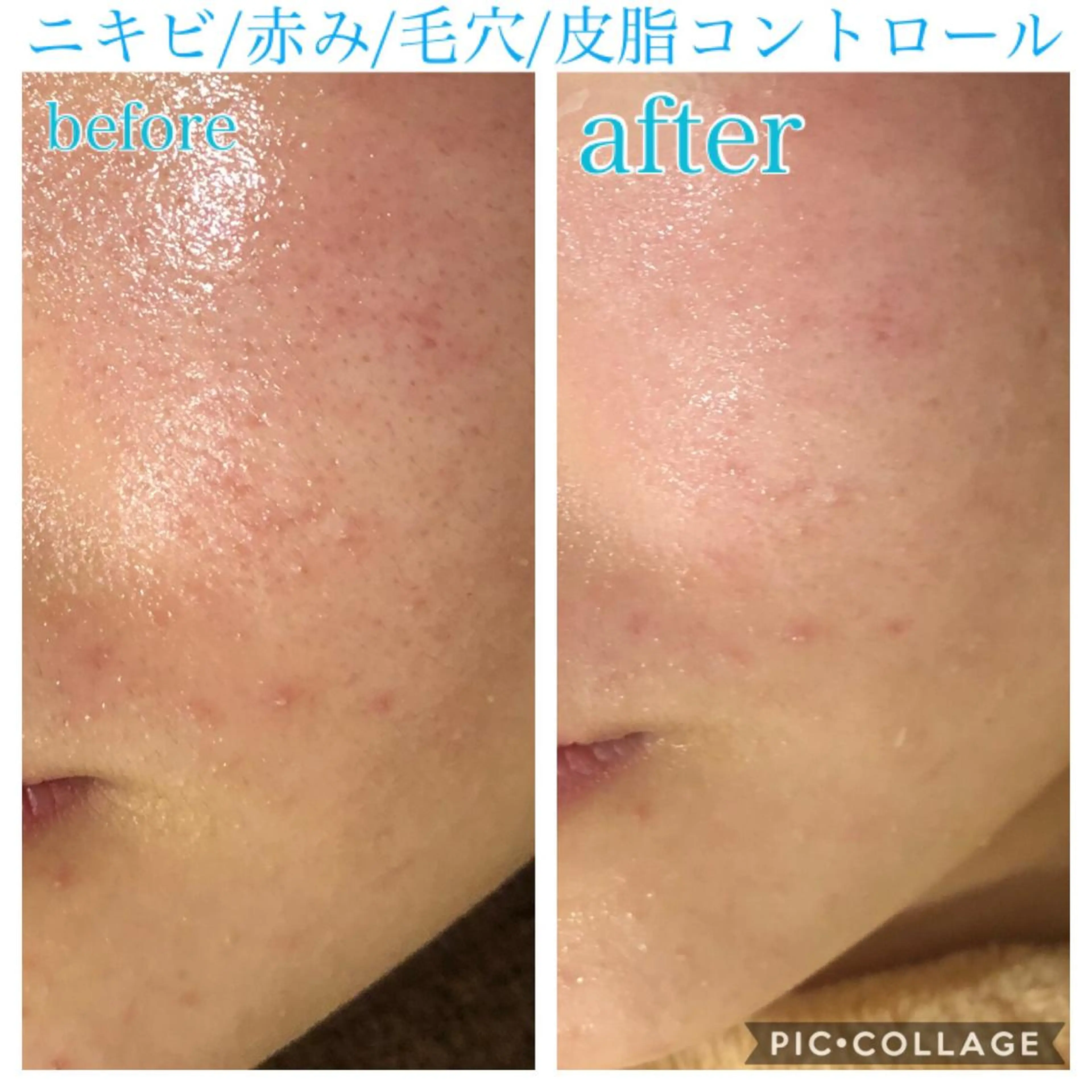 ロング カラー パーマ ヘアアレンジ キッズ ネイル マツエク・マツパ エステ リラク EnsorClair 代表　野口真央のエステ・リラクイメージ