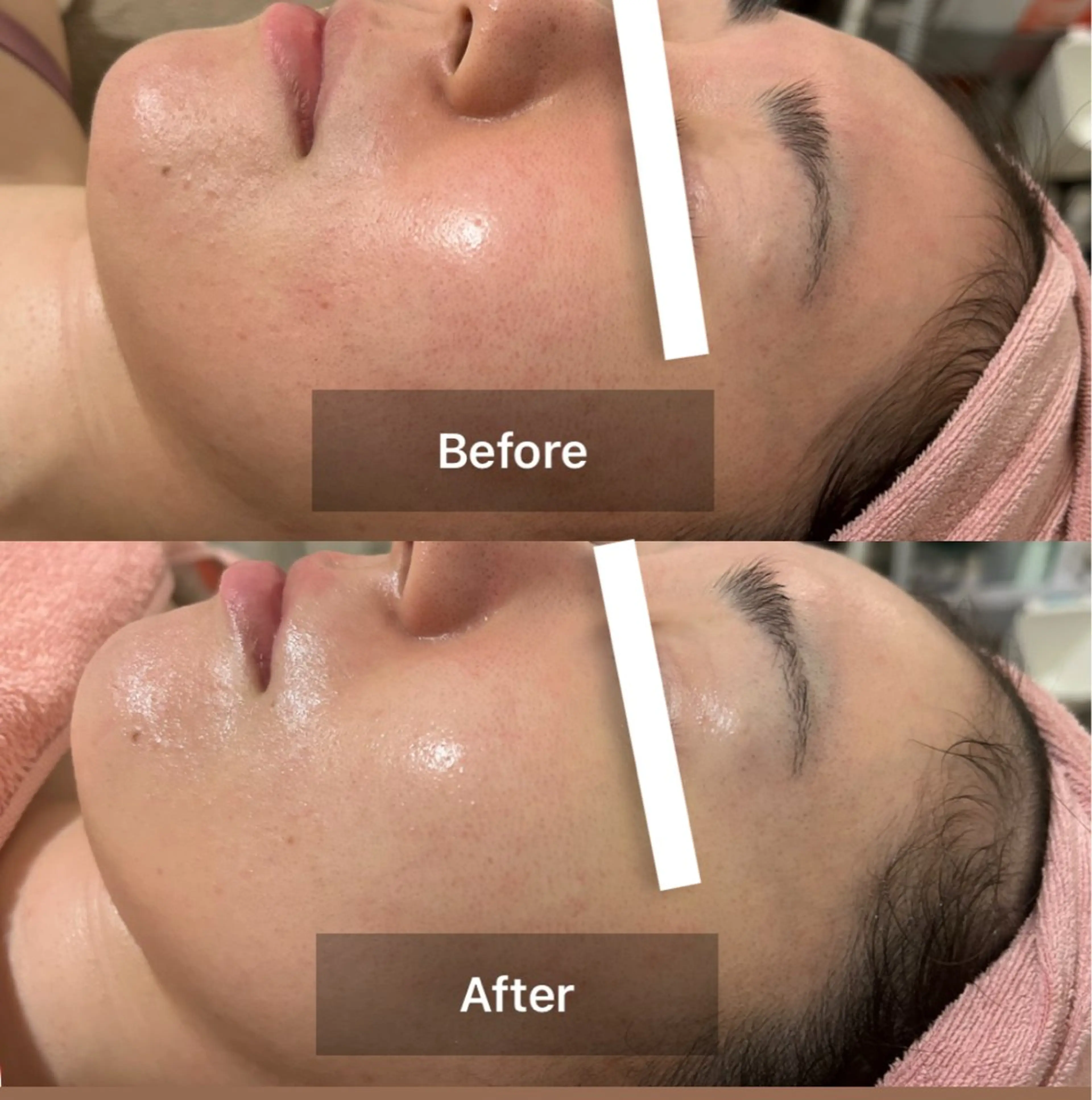 エクラヴィ 小顔・エイジングケアのエステ・リラクイメージ