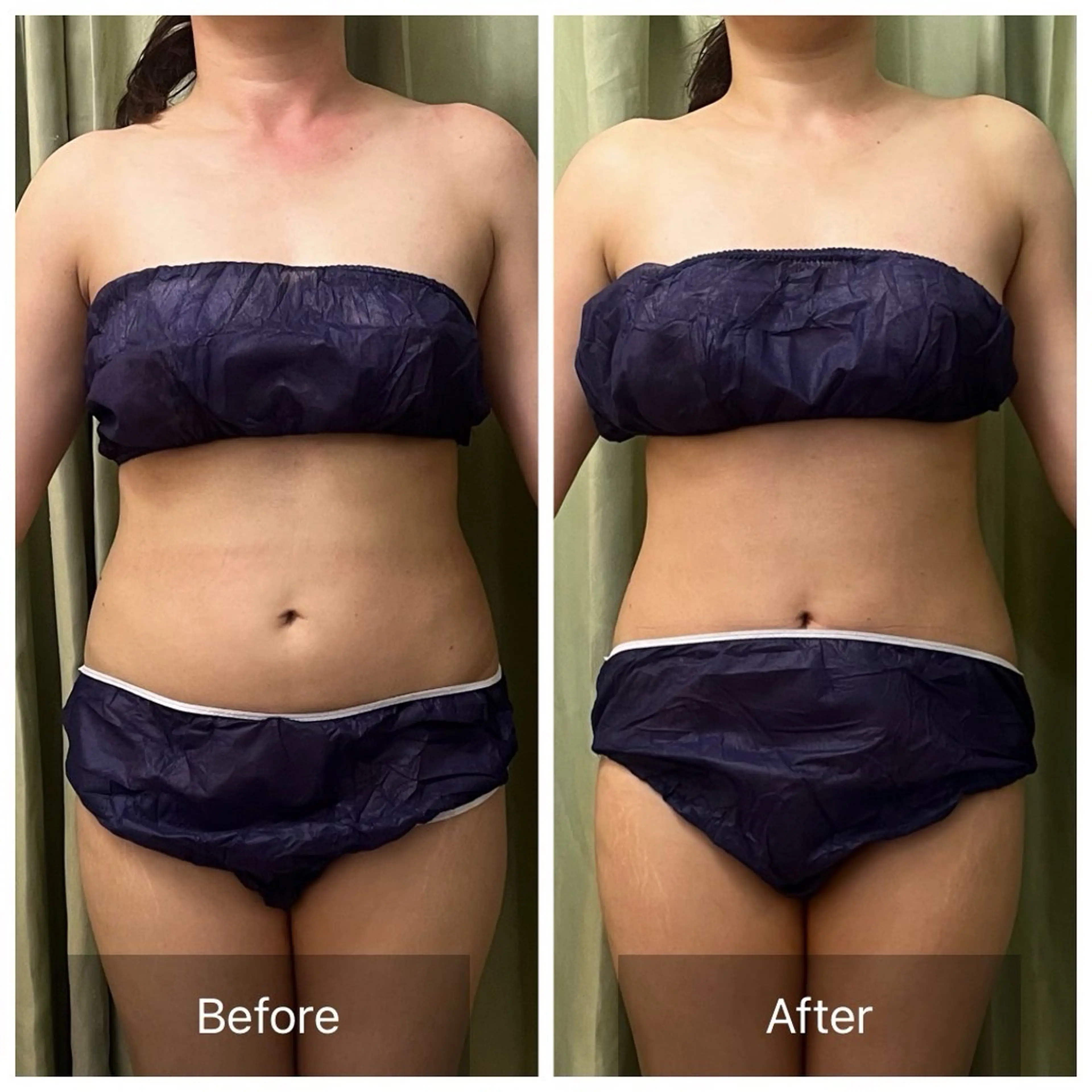 筋膜専門🌿 ウェルネスラボ星ヶ丘のエステ・リラクイメージ