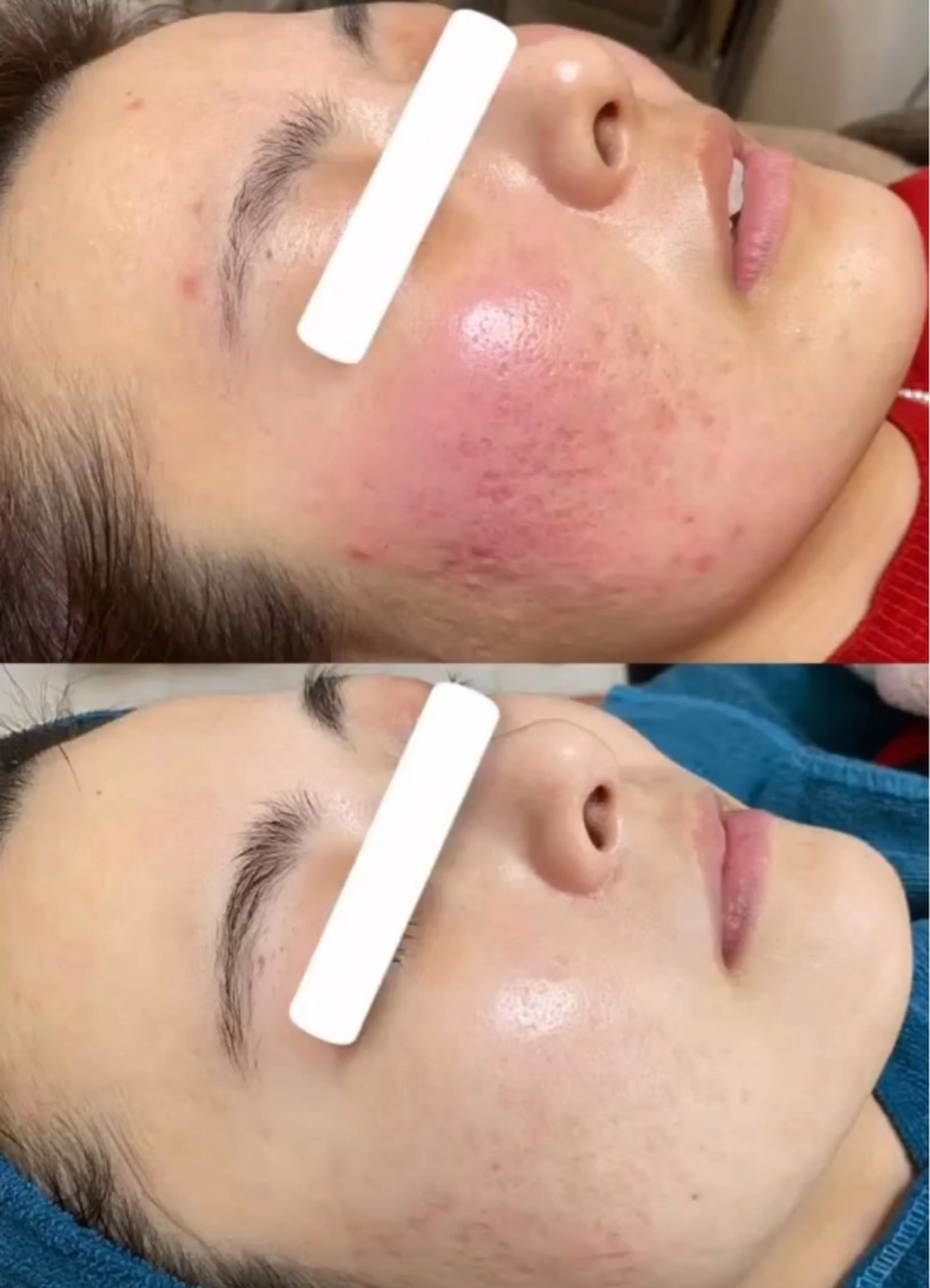 エステ リラク パーソナルスキンケア 🦋APRI🅿️有のエステ・リラクイメージ