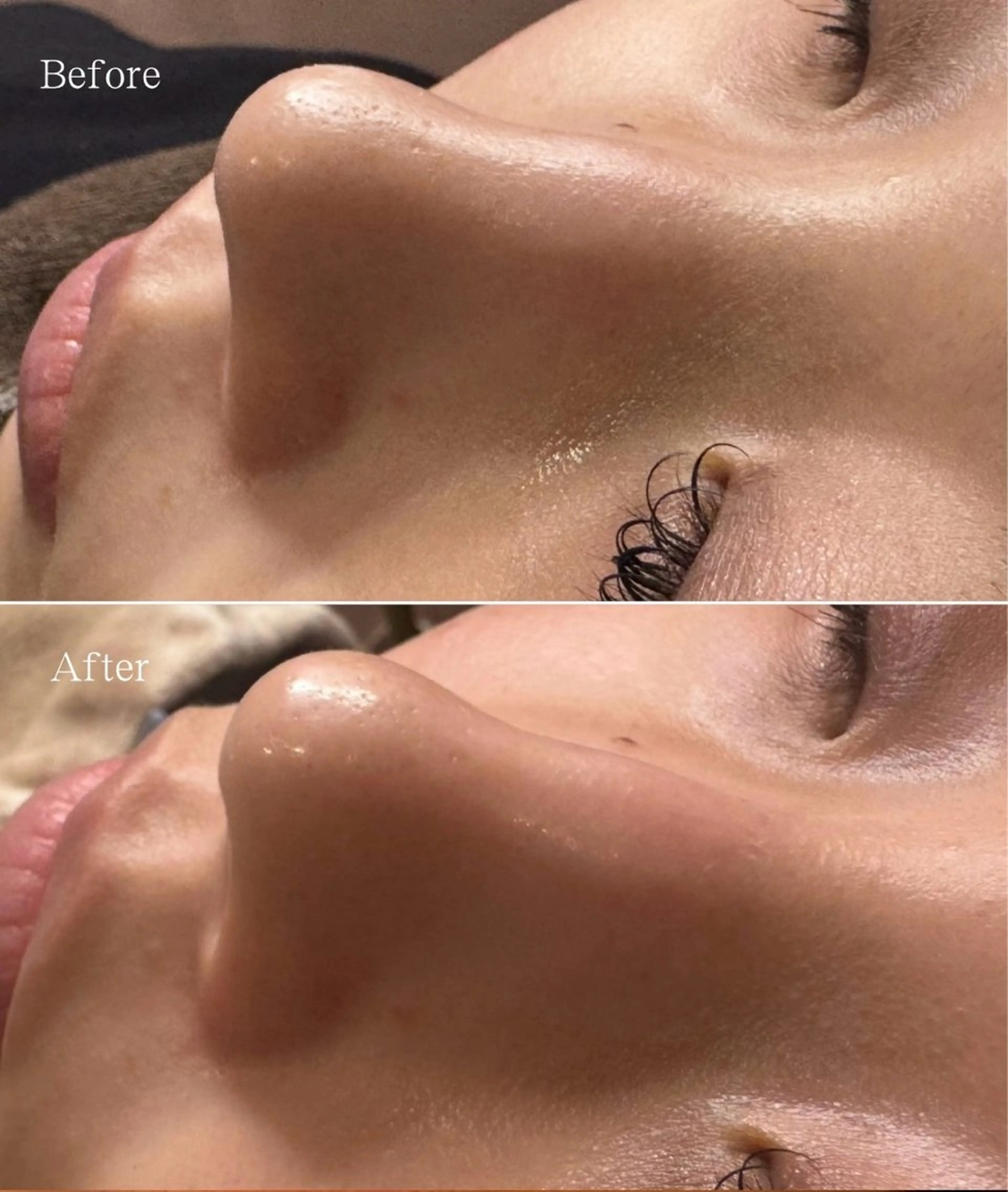 エステ 新宿大久保美容サロン BELL  マイのその他イメージ