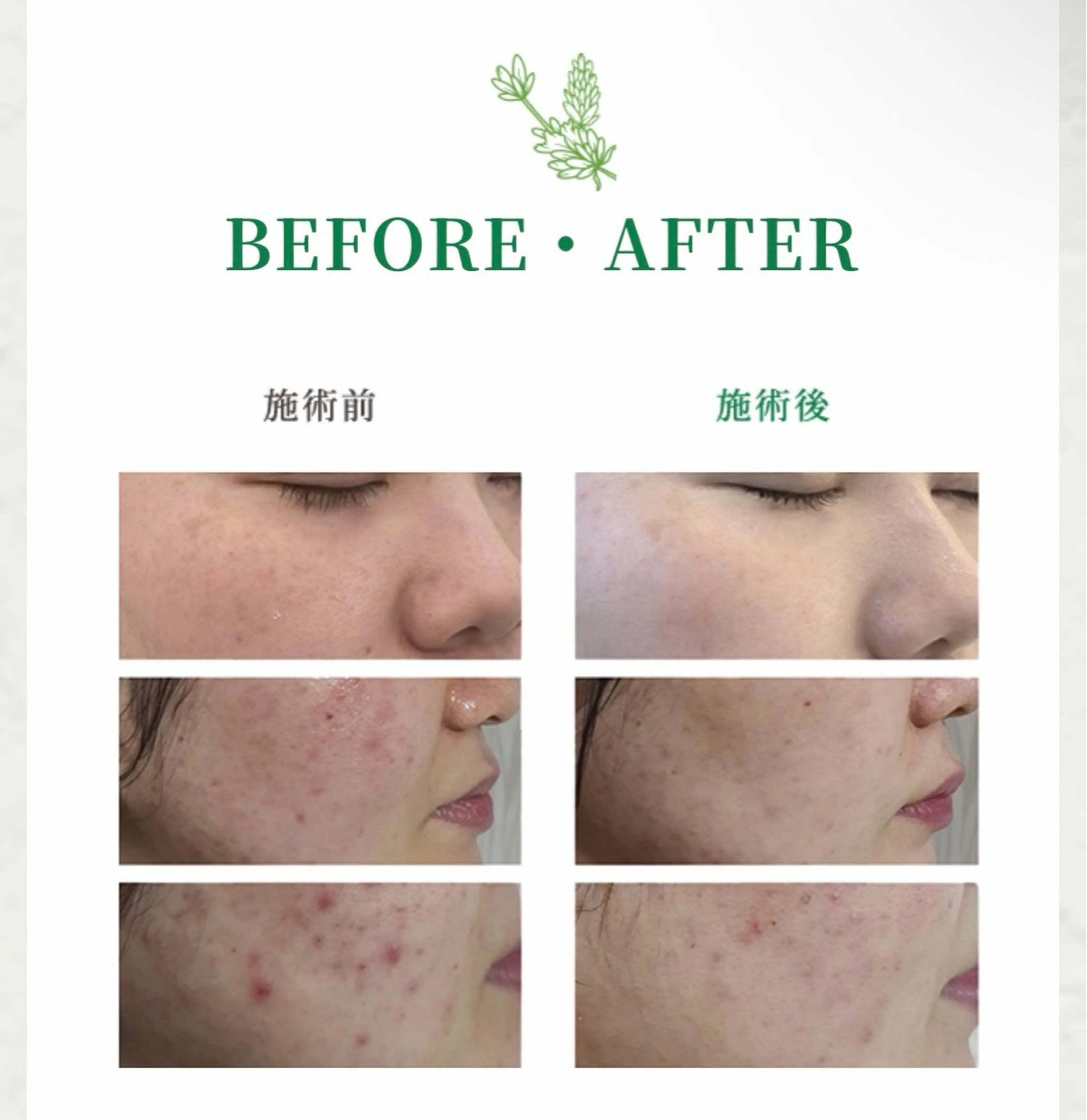 フルフィル名取美田園 MIYUKIのエステ・リラクイメージ