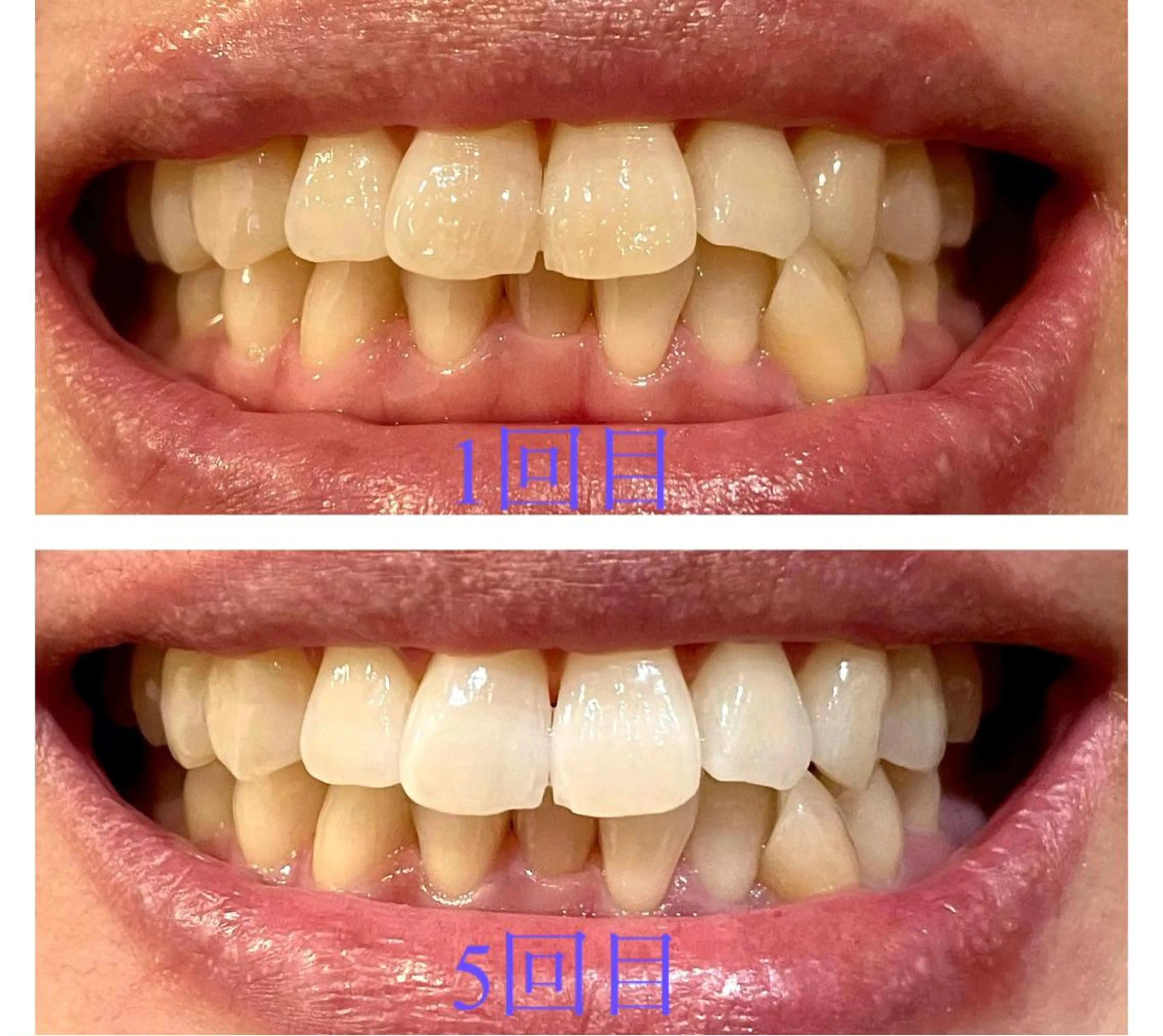 その他 朝倉 香織のマツエク・マツパデザイン