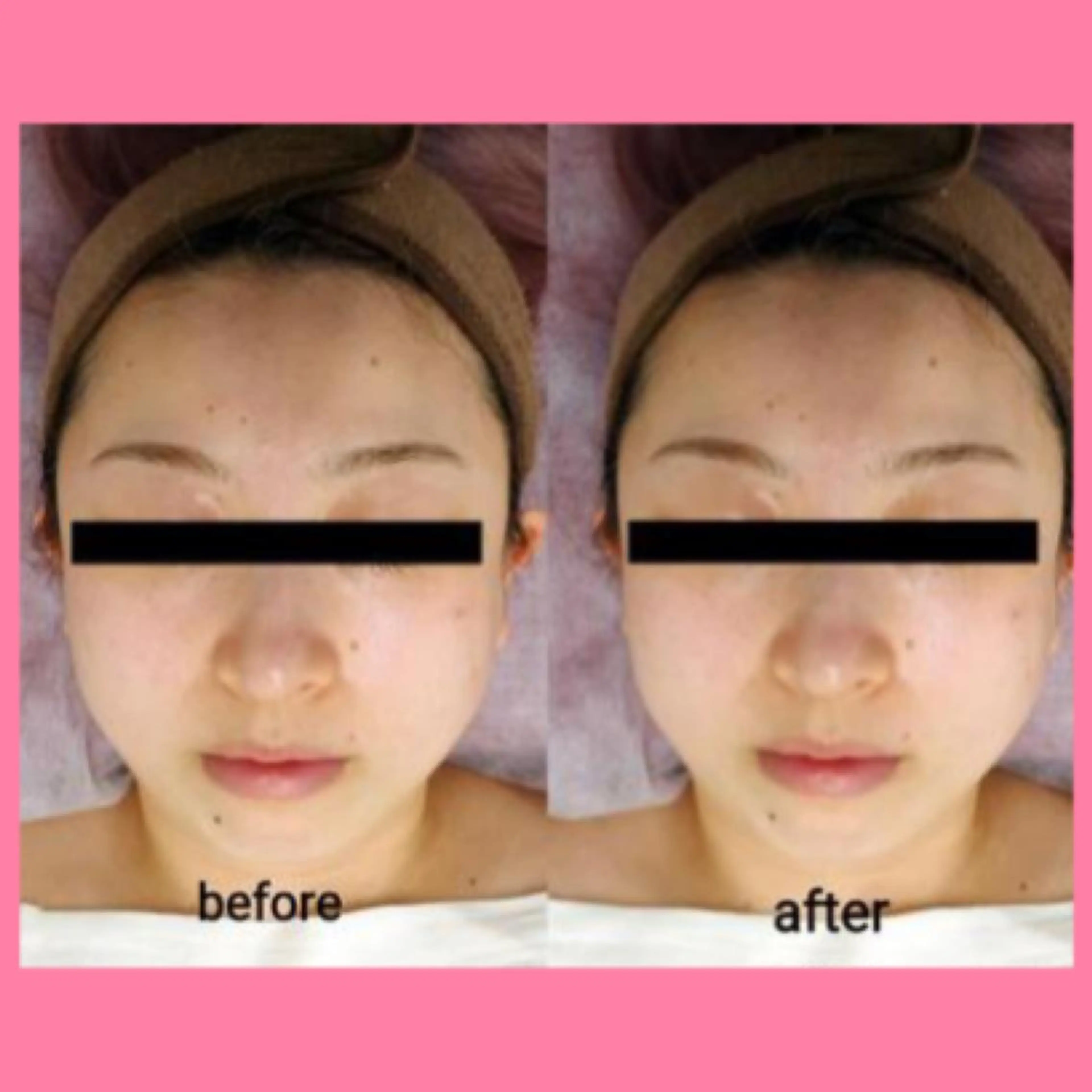 肌ケア＆毛穴洗浄 Cheri/女性専用のエステ・リラクイメージ