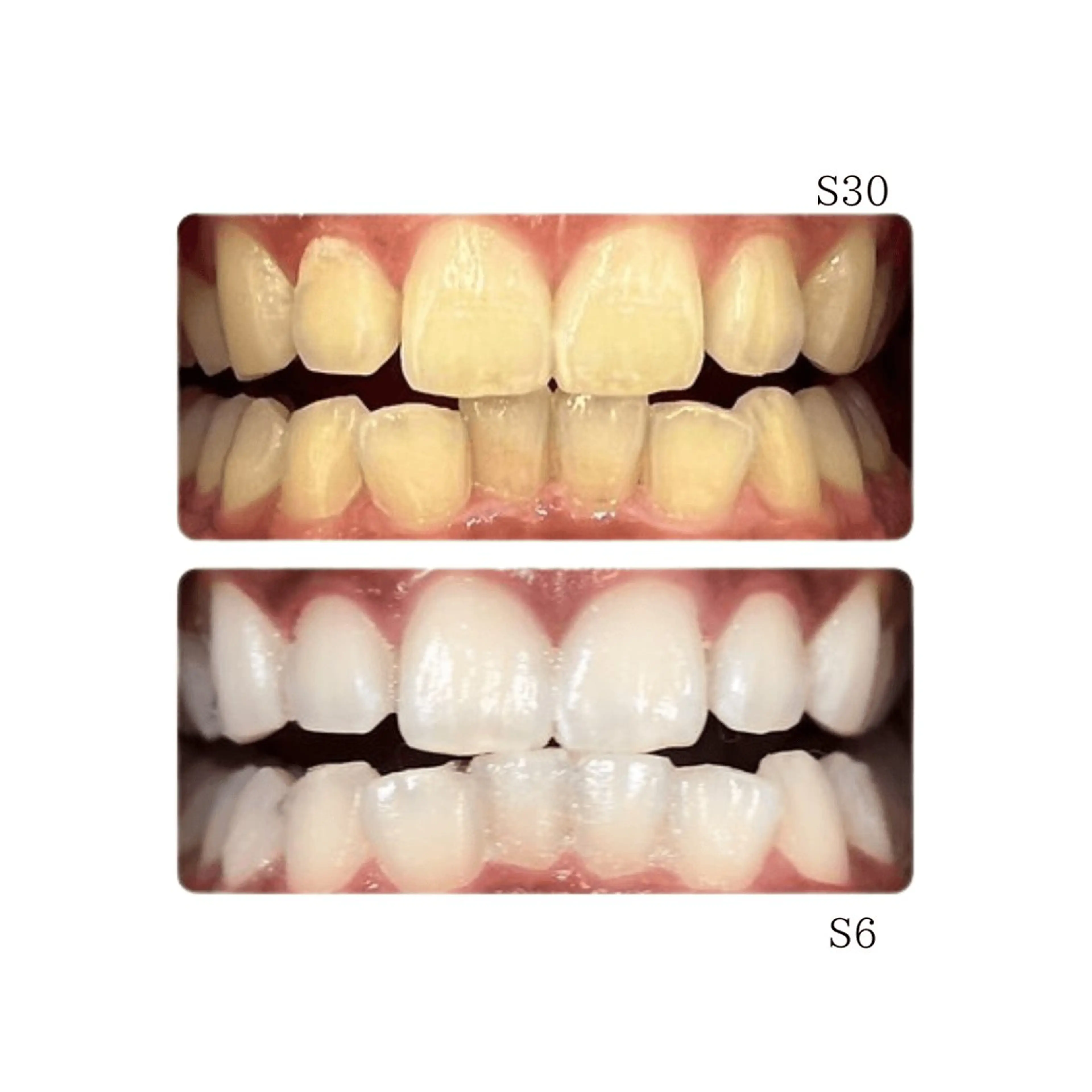 東区香椎歯のセルフホ ワイトニングGLOWのその他イメージ