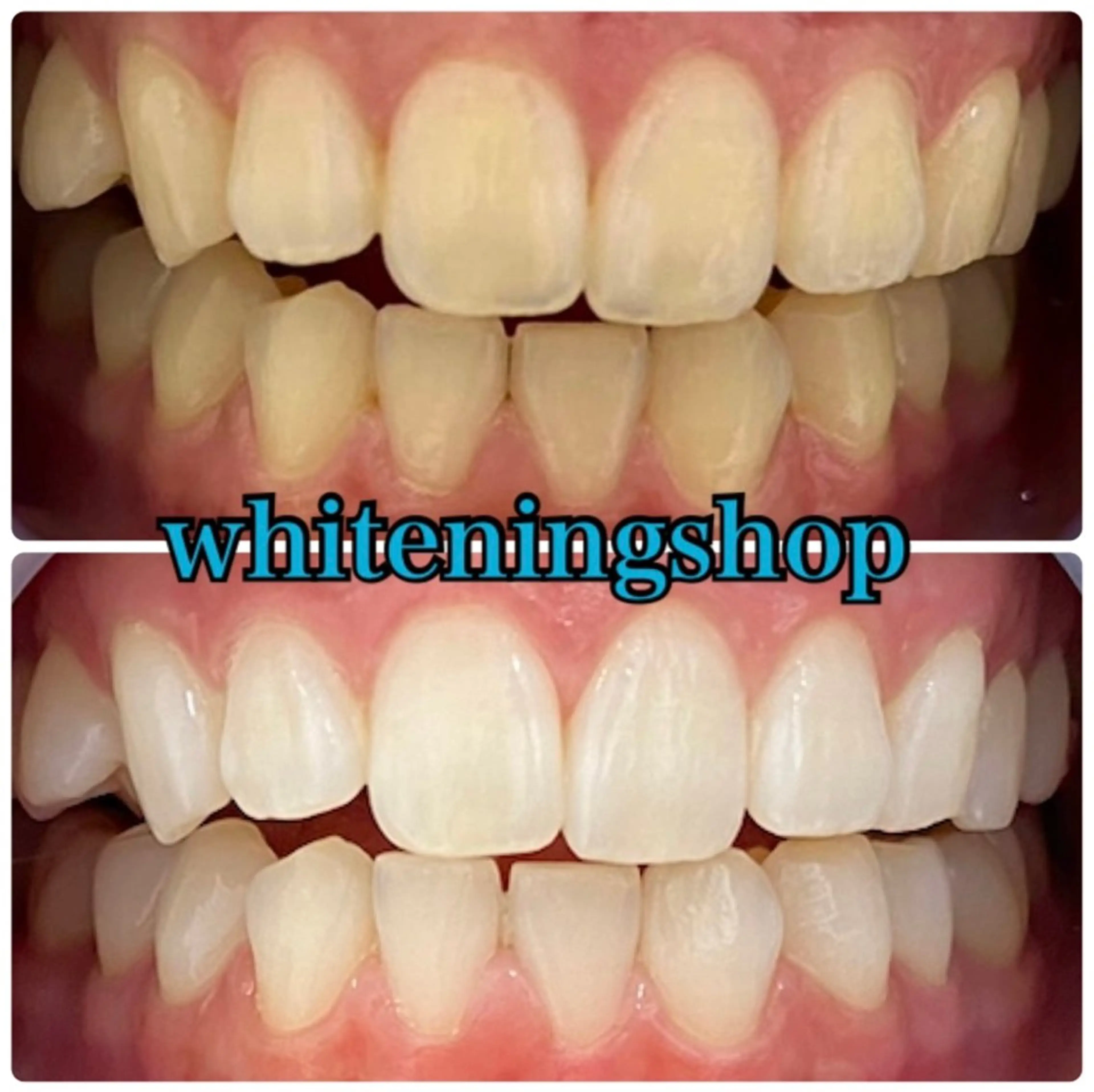 エステ リラク ホワイトニング ショップ吉祥寺店のエステ・リラクイメージ