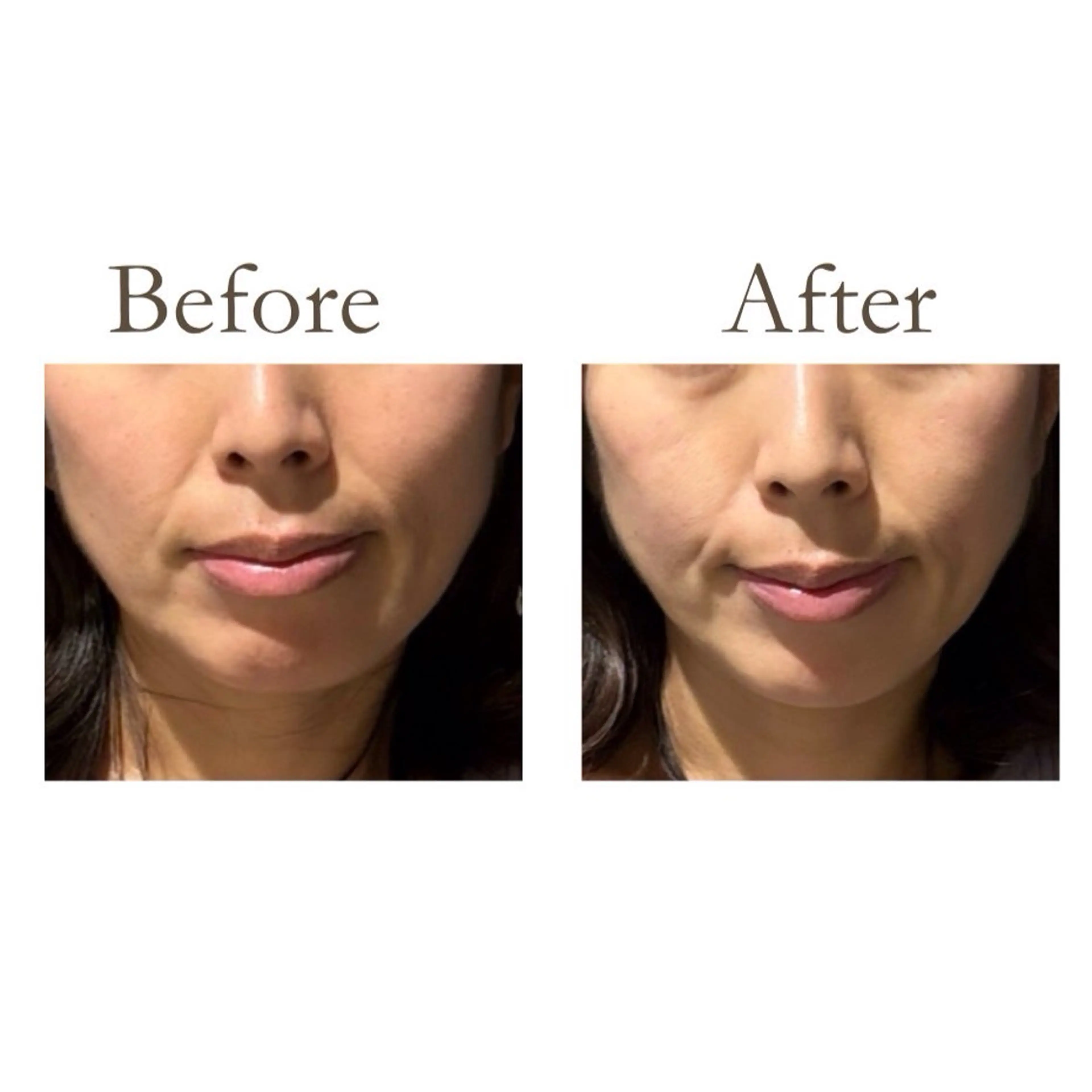 健康×美容鍼鍼灸院 あさば整骨院南流山店のエステ・リラクイメージ