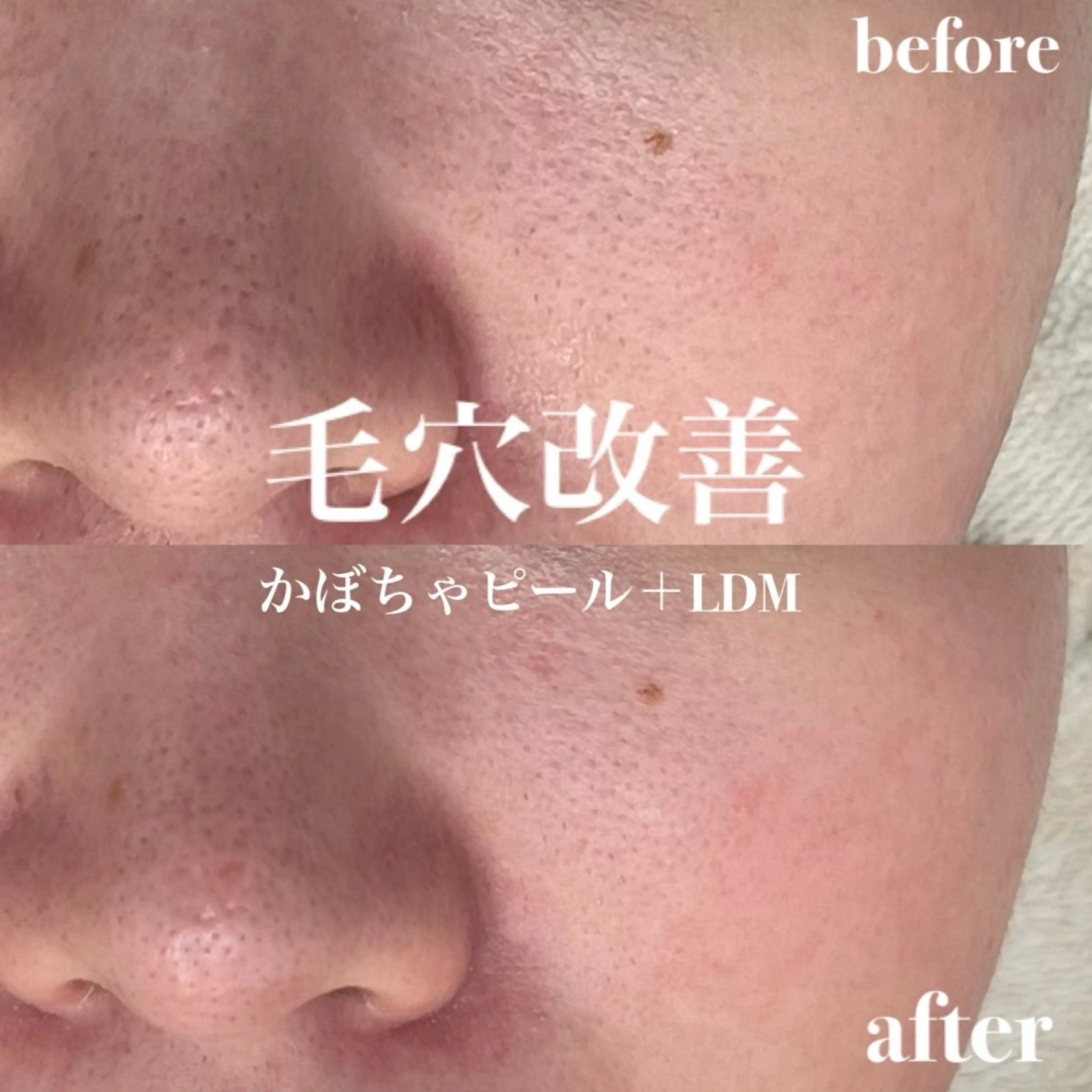 韓国肌管理&小顔 ＩＲＯＨＡのエステ・リラクイメージ