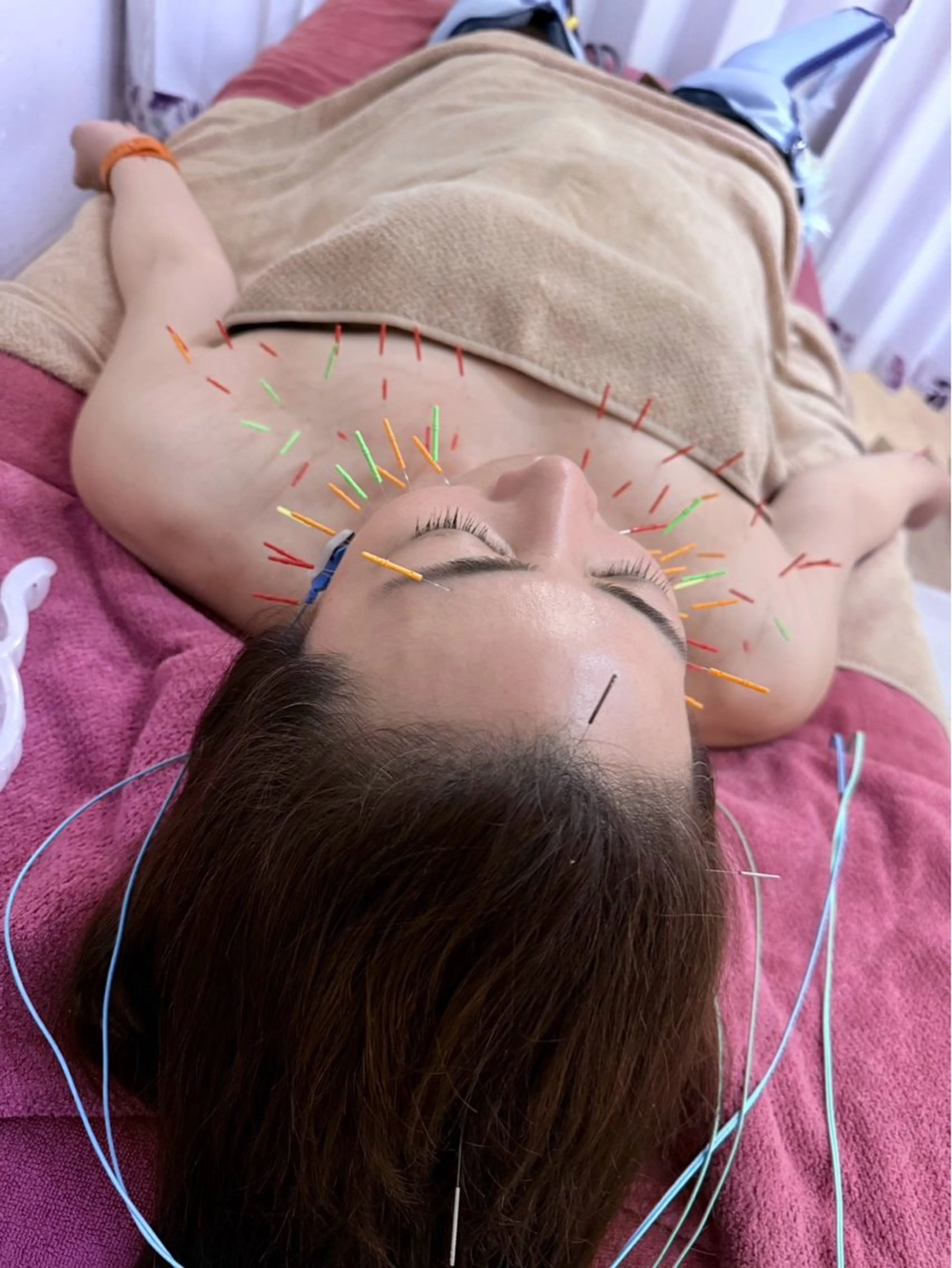 その他 美容鍼灸女性専用 りんご鍼灸治療院のその他イメージ