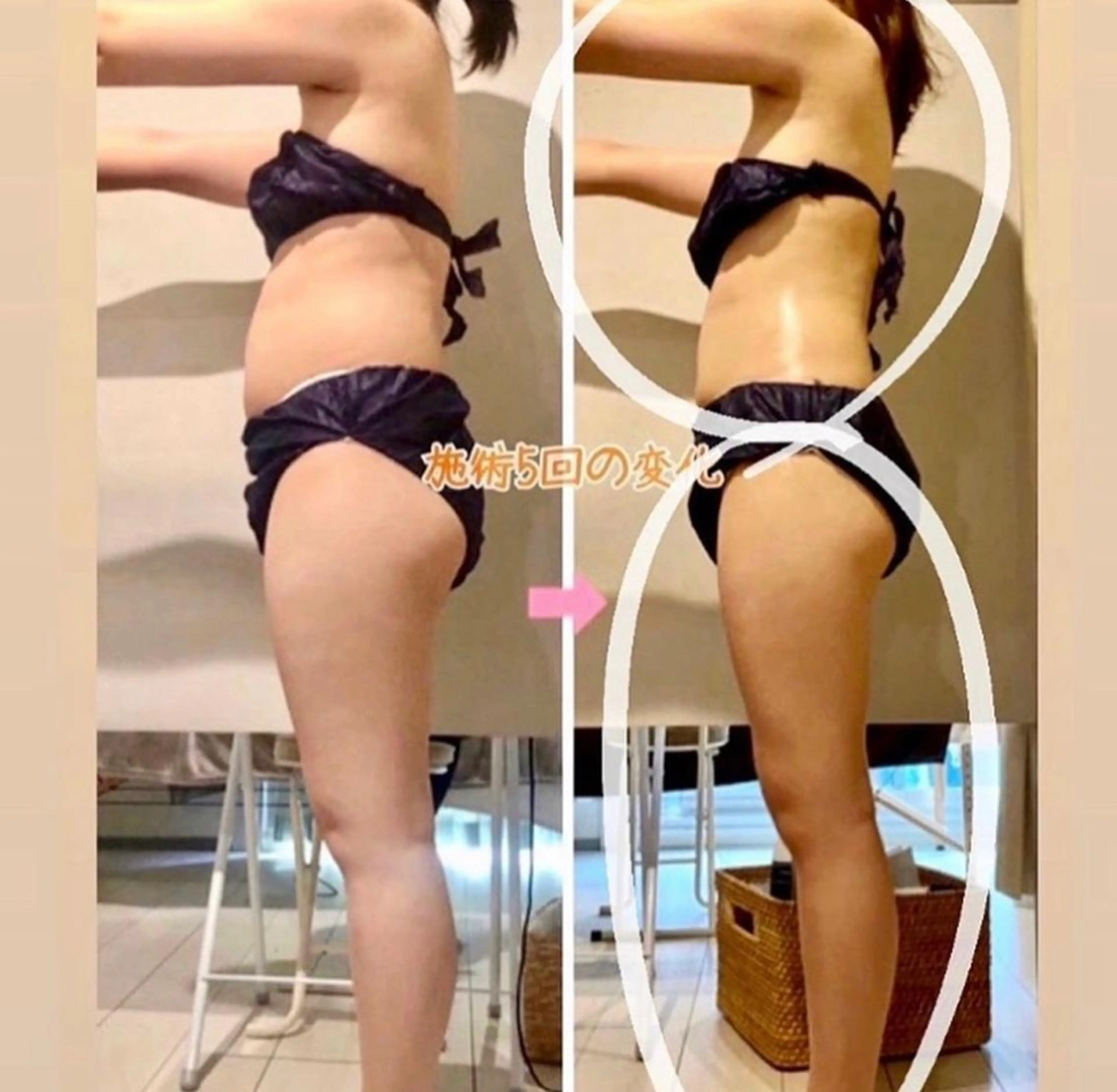 ショート カラー パーマ ヘアアレンジ メンズ キッズ ネイル マツエク・マツパ アイブロウ トリートメント エステ リラク ‍痩身＆ボディ 結果出し🌟丹野のエステ・リラクイメージ