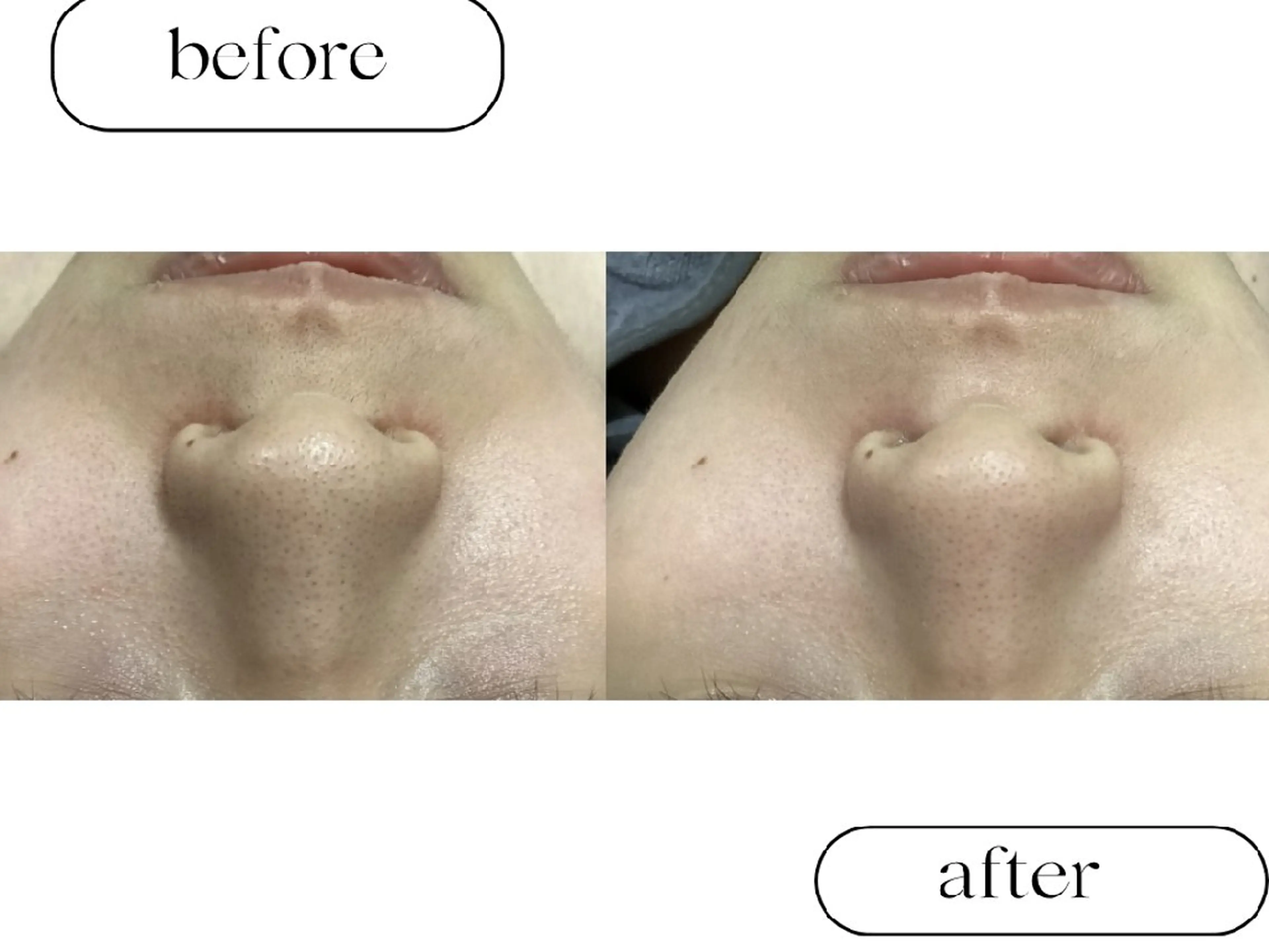 美肌専門サロン RUBONのエステ・リラクイメージ