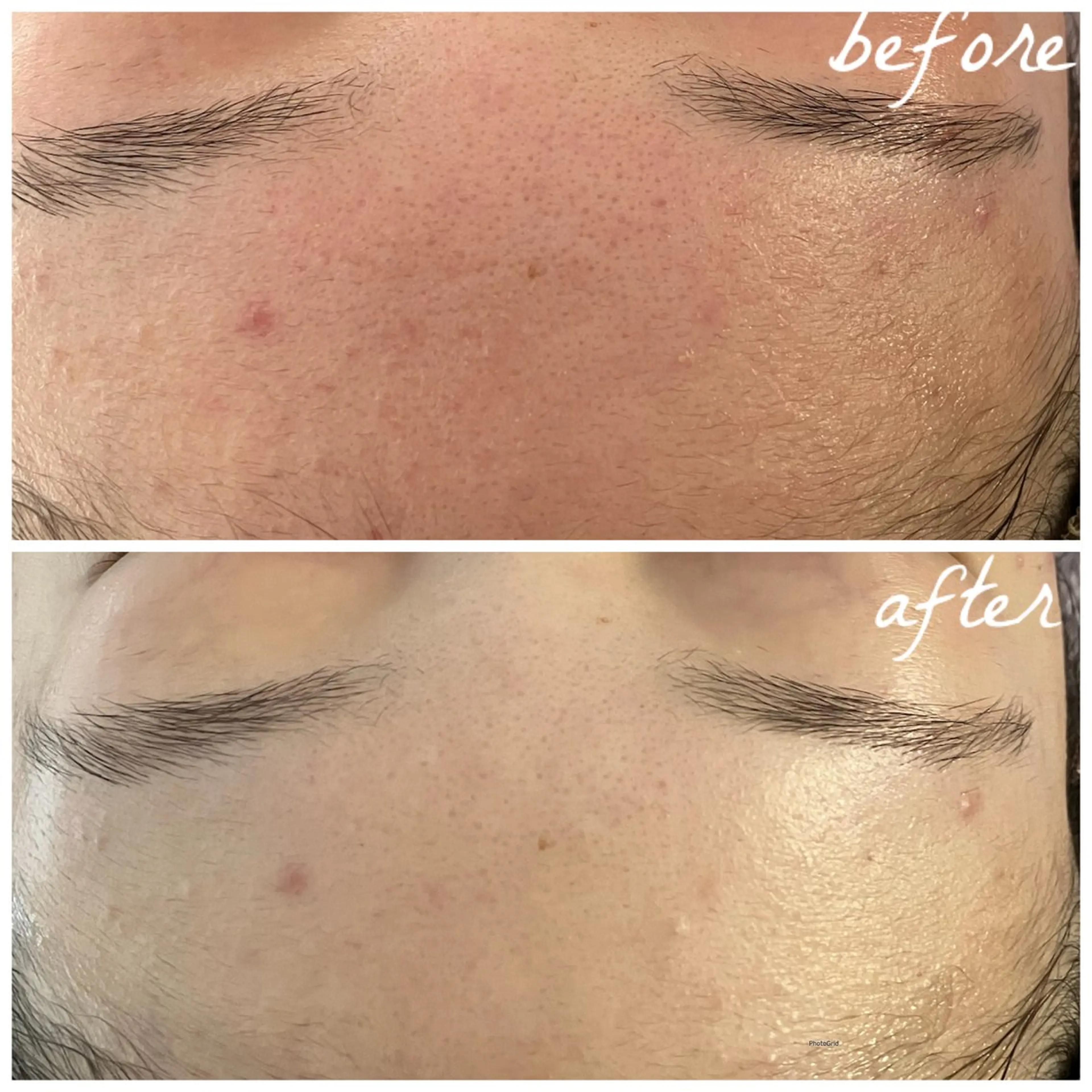 メンズ エステ メナード岐阜市茜部 杉浦のエステ・リラクイメージ