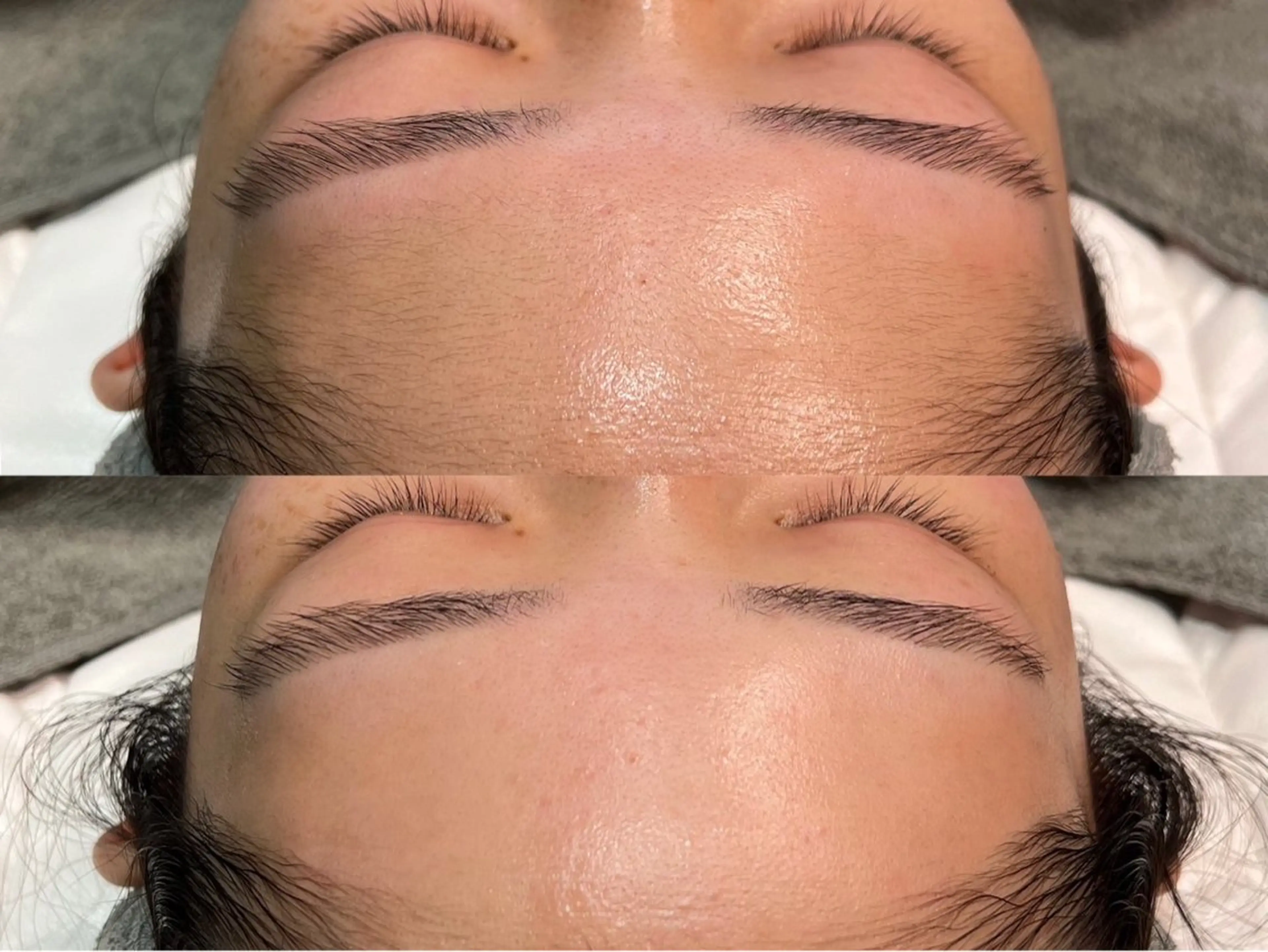 フルフェイスWAX脱毛×贅沢パック付⭕️の写真