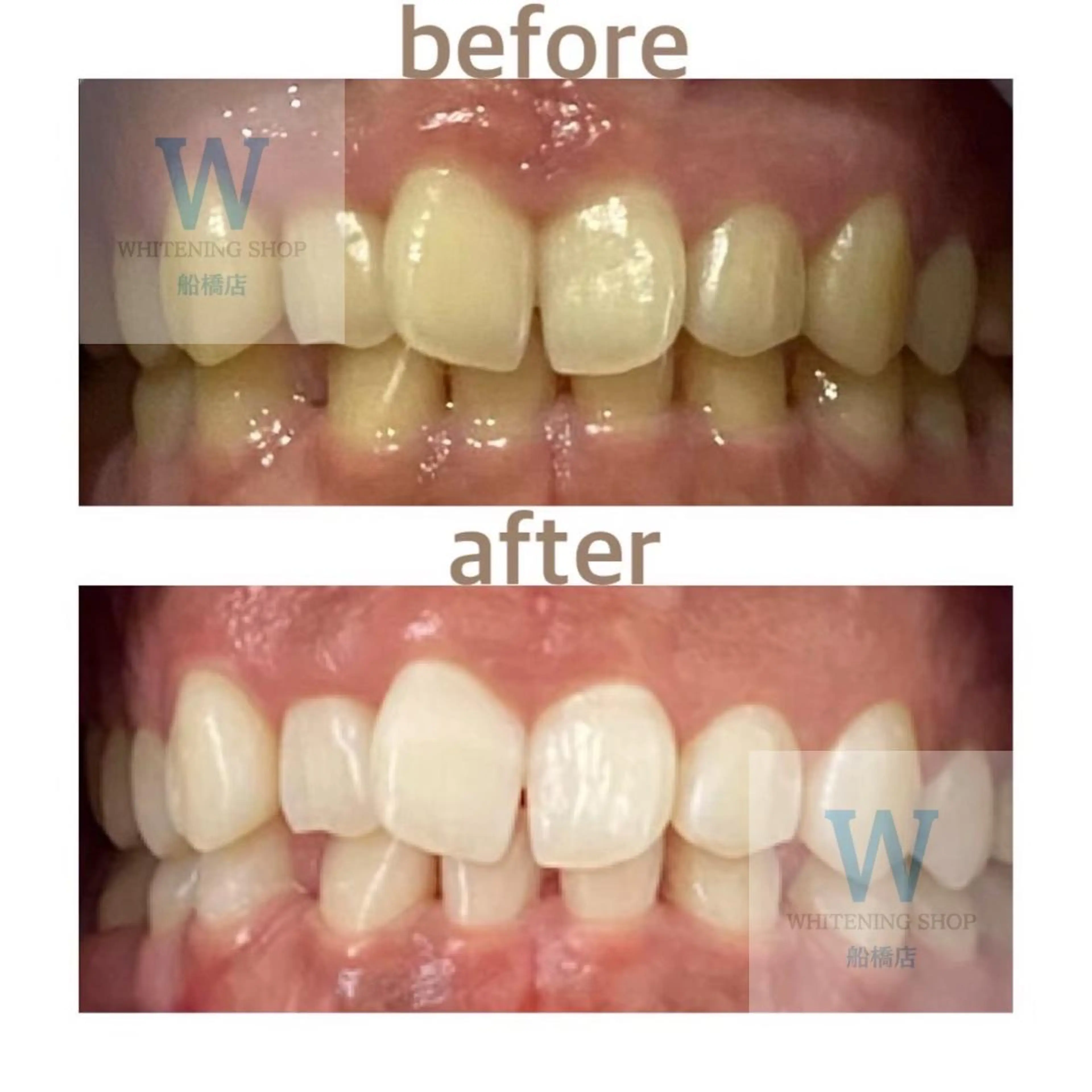 エステ リラク ホワイトニング ショップ船橋店🦷のエステ・リラクイメージ