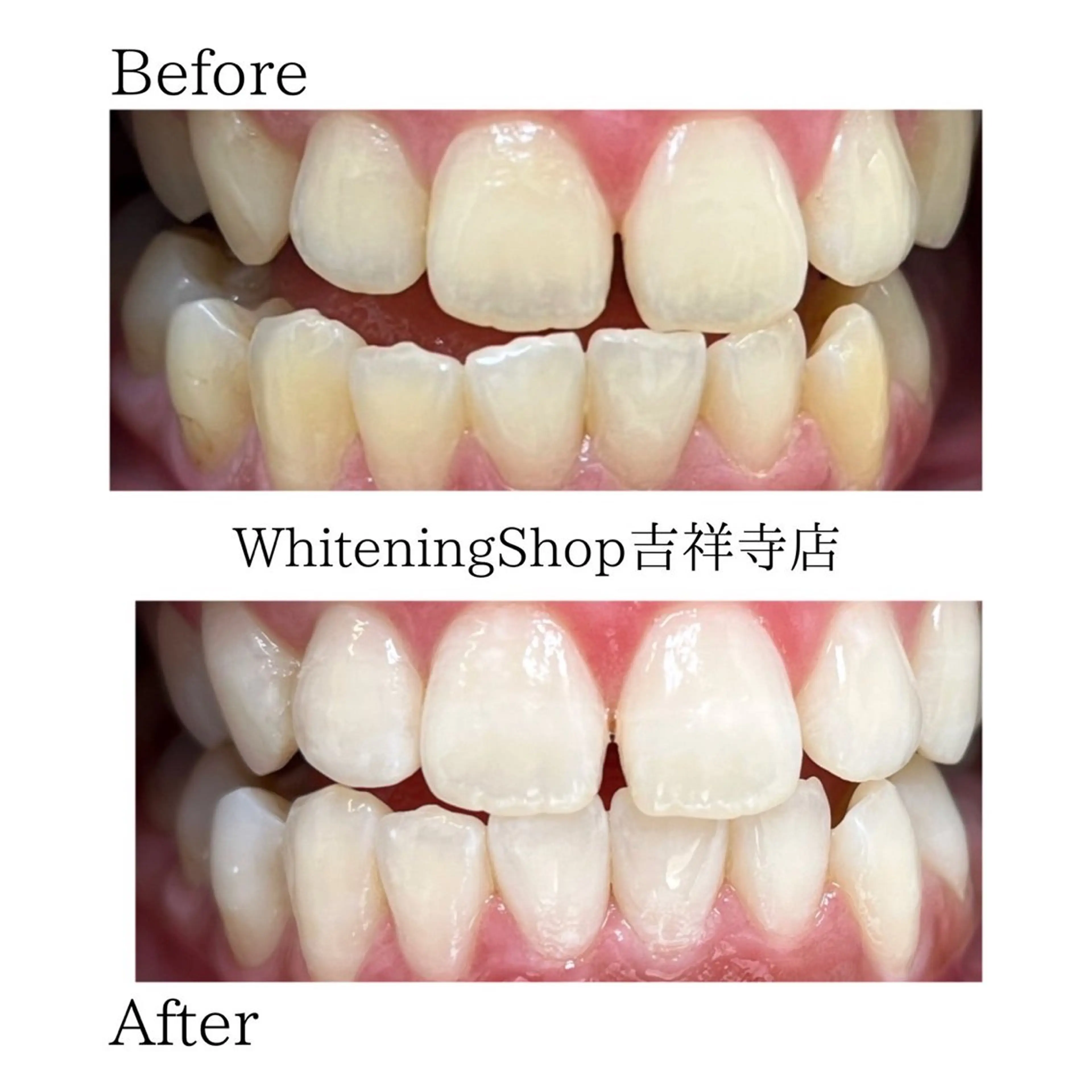 エステ リラク ホワイトニング ショップ吉祥寺店のエステ・リラクイメージ