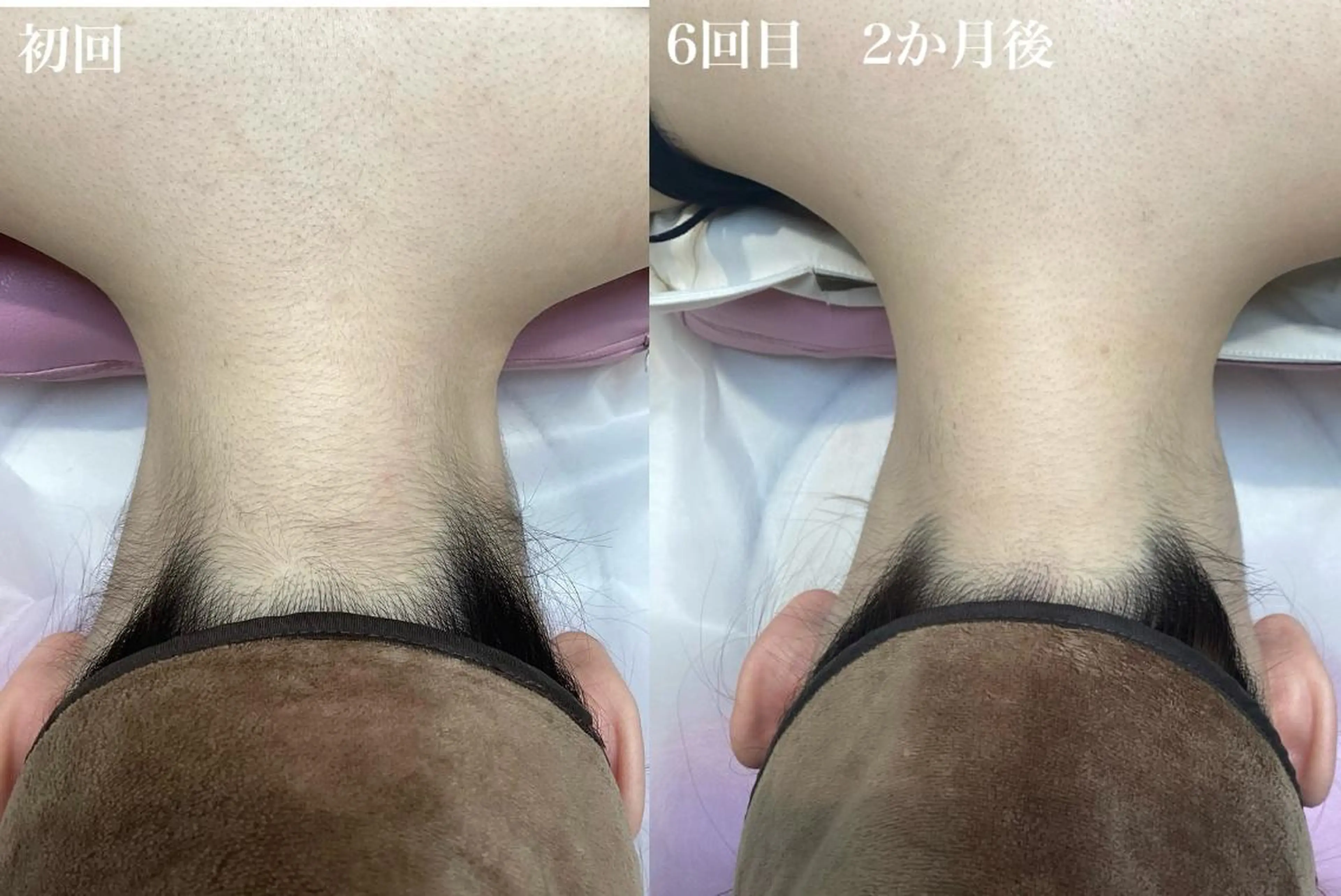 U24限定クーポン レイビス池袋MANAのエステ・リラクイメージ