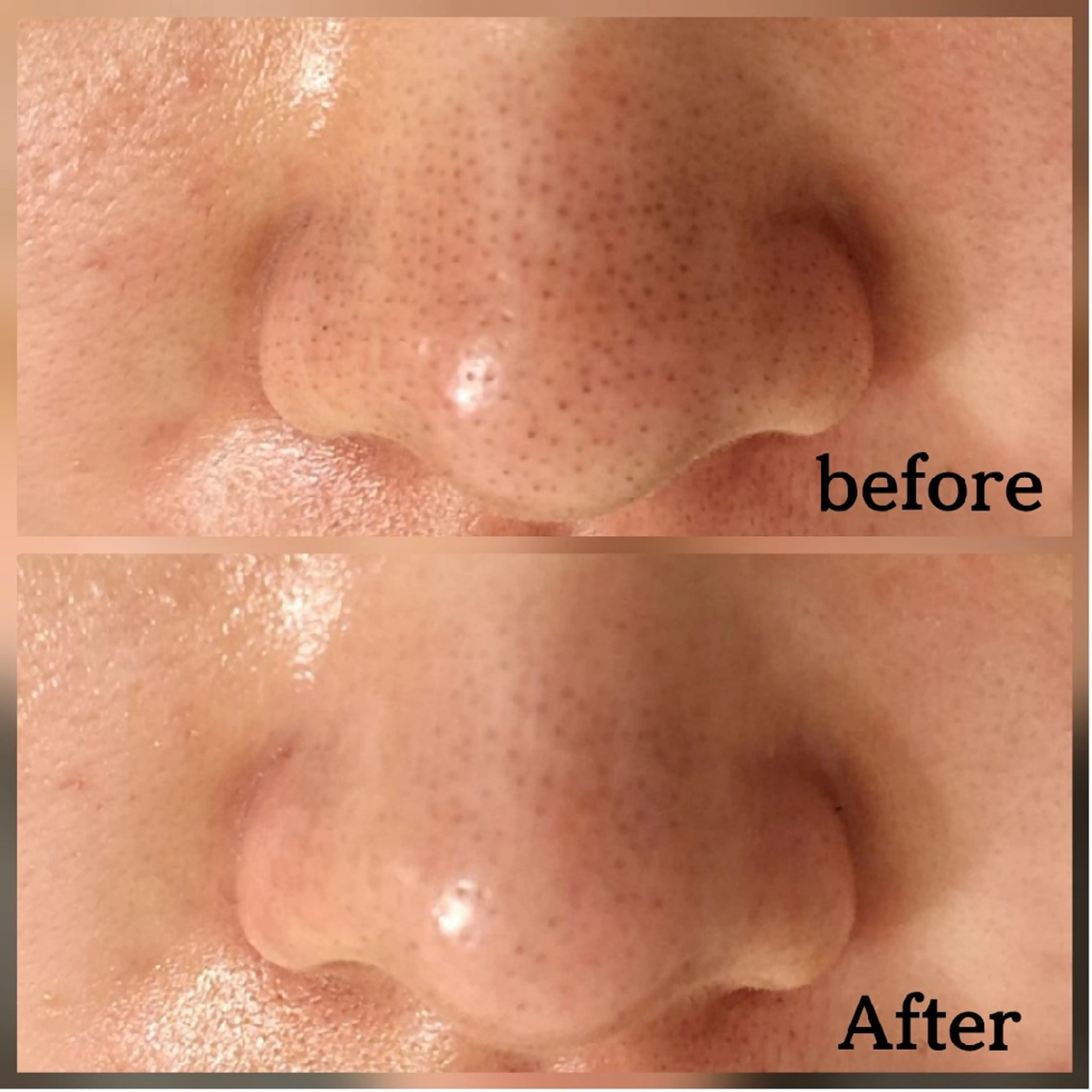 フェイシャル専門サロ ン　ERINのエステ・リラクイメージ