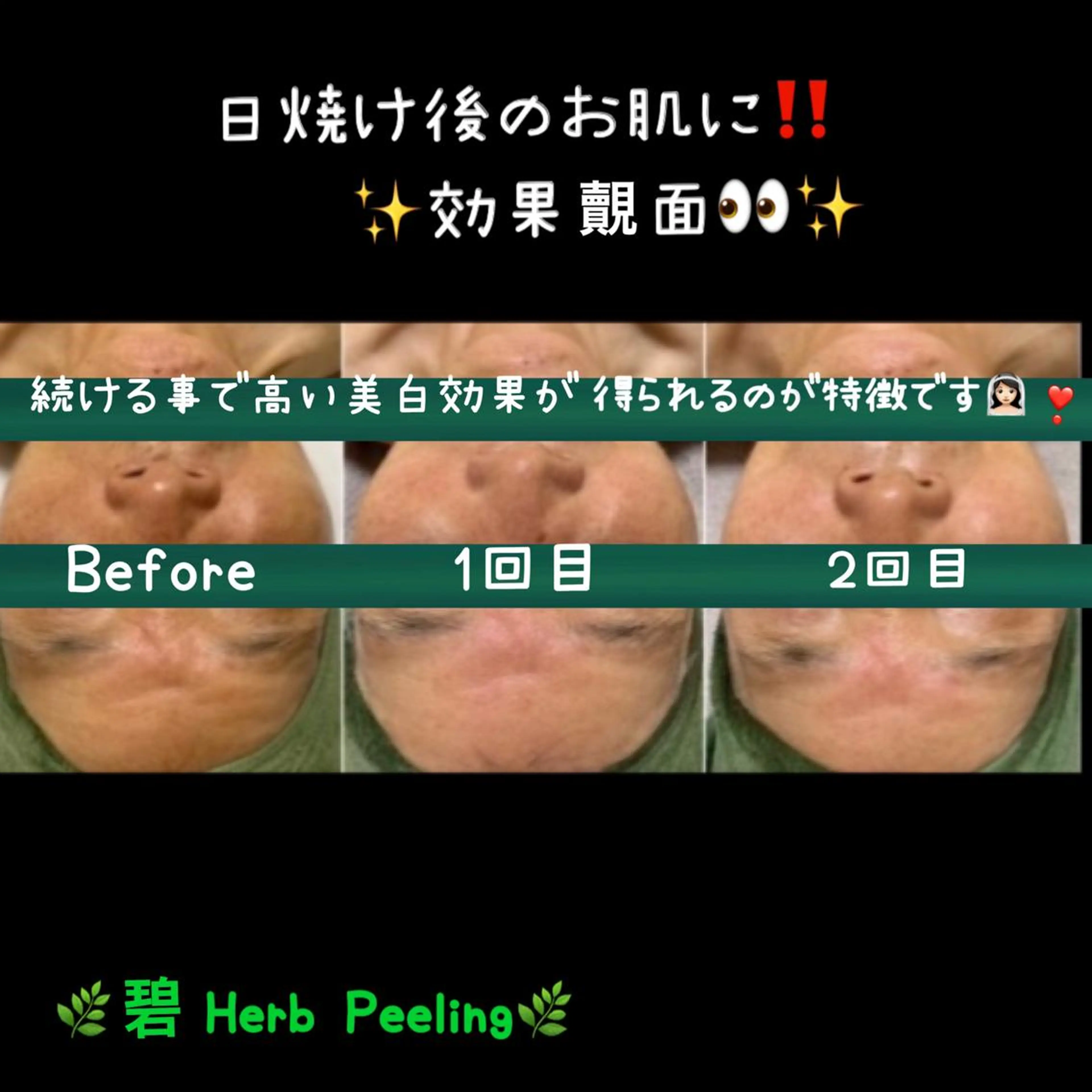 エステ ヴィーナス ビューティーのエステ・リラクイメージ