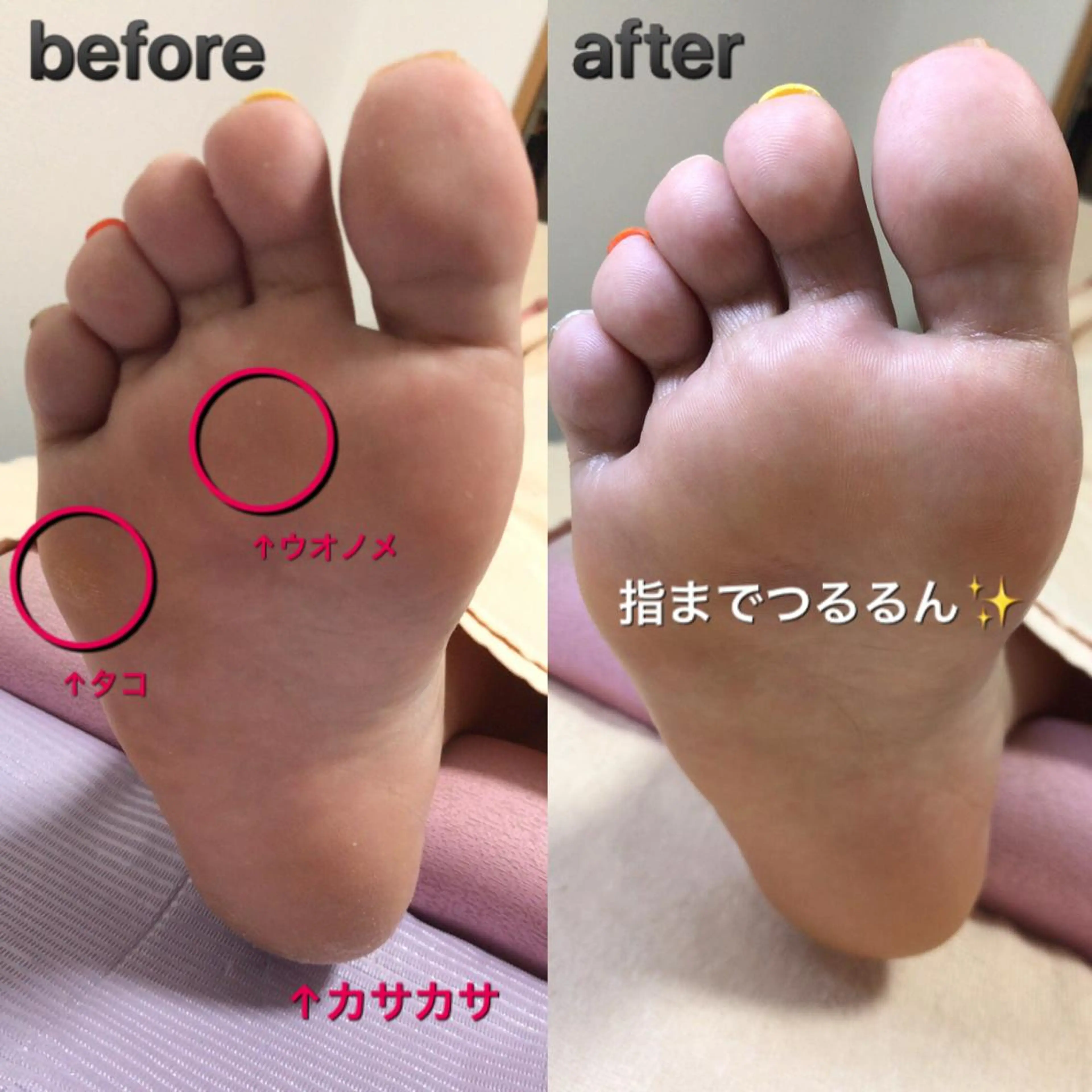 ネイル フットネイル ステラ marikominoのネイルデザイン