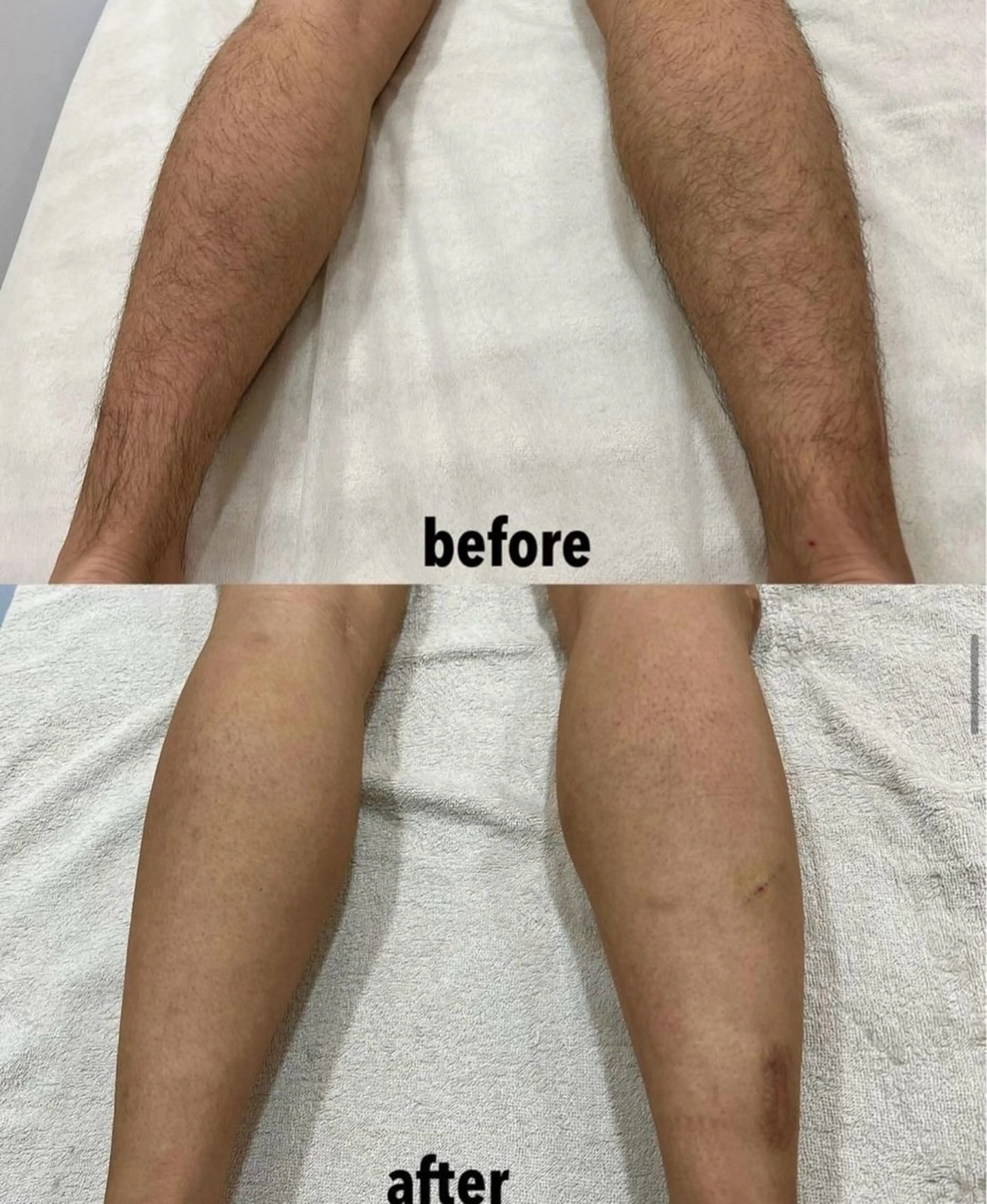 メンズ 脱毛 瀬戸 梨子のエステ・リラクイメージ