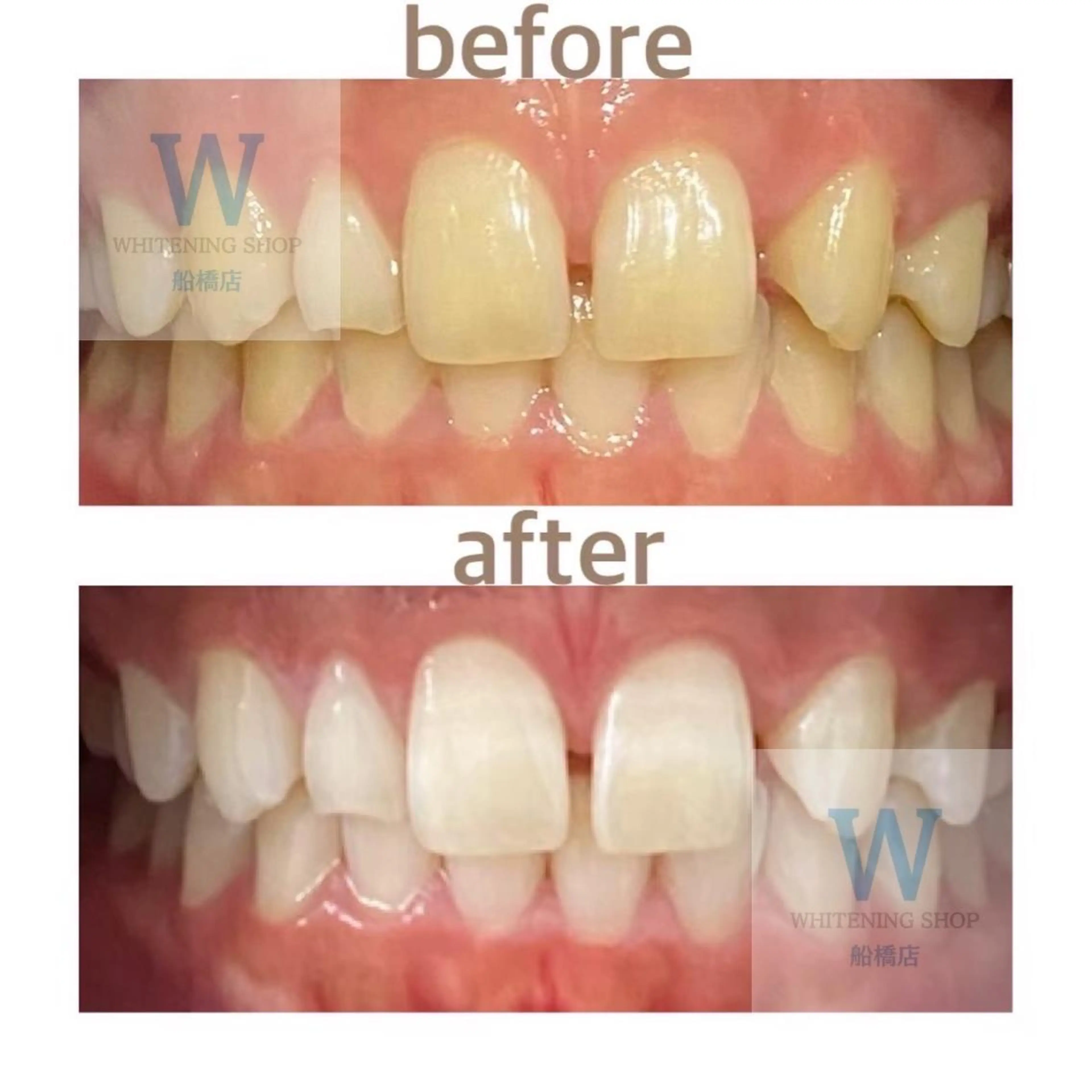 エステ リラク ホワイトニング ショップ船橋２号店のエステ・リラクイメージ