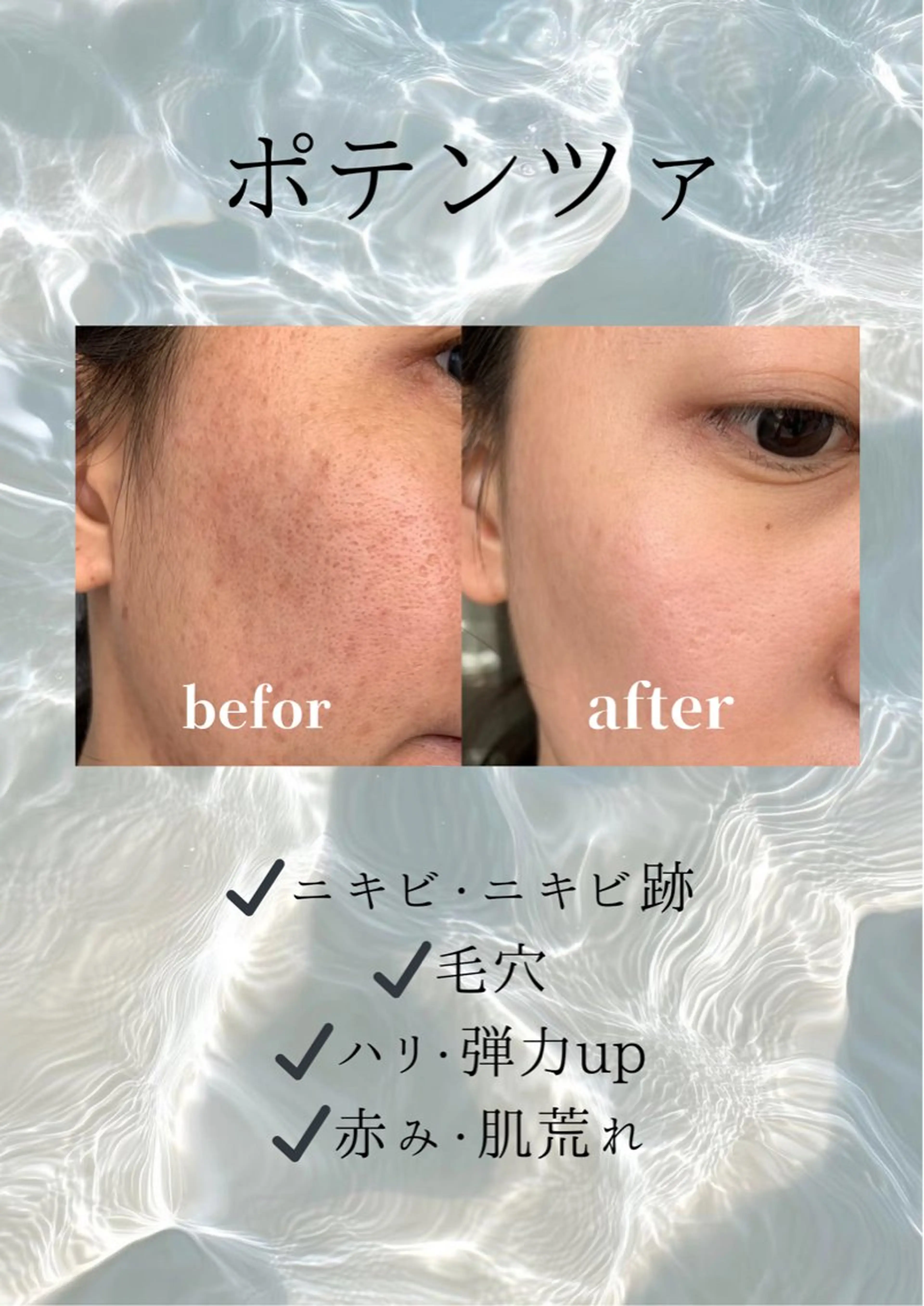 マツエク・マツパ エステ 愛維美水光美肌専門店 メンズレディースokのエステ・リラクイメージ