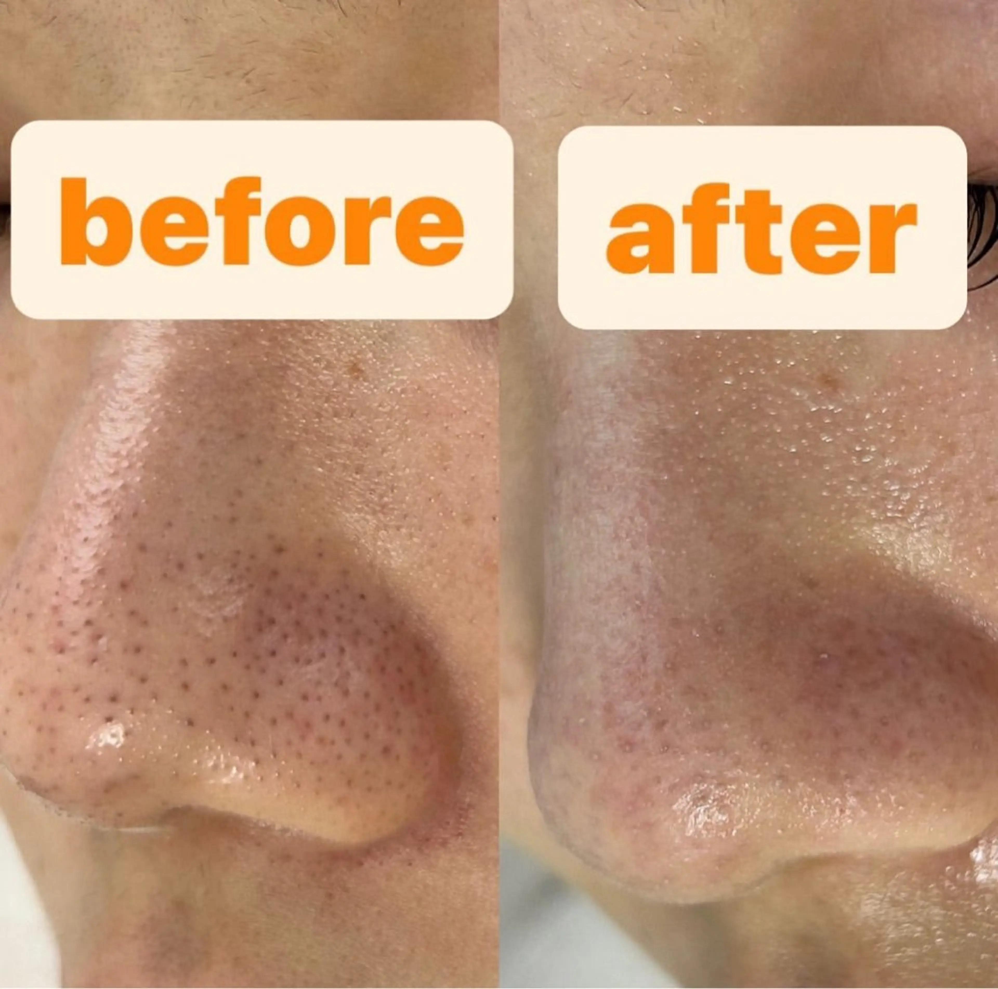 都度払い肌改善専門店 店長二上文香のエステ・リラクイメージ