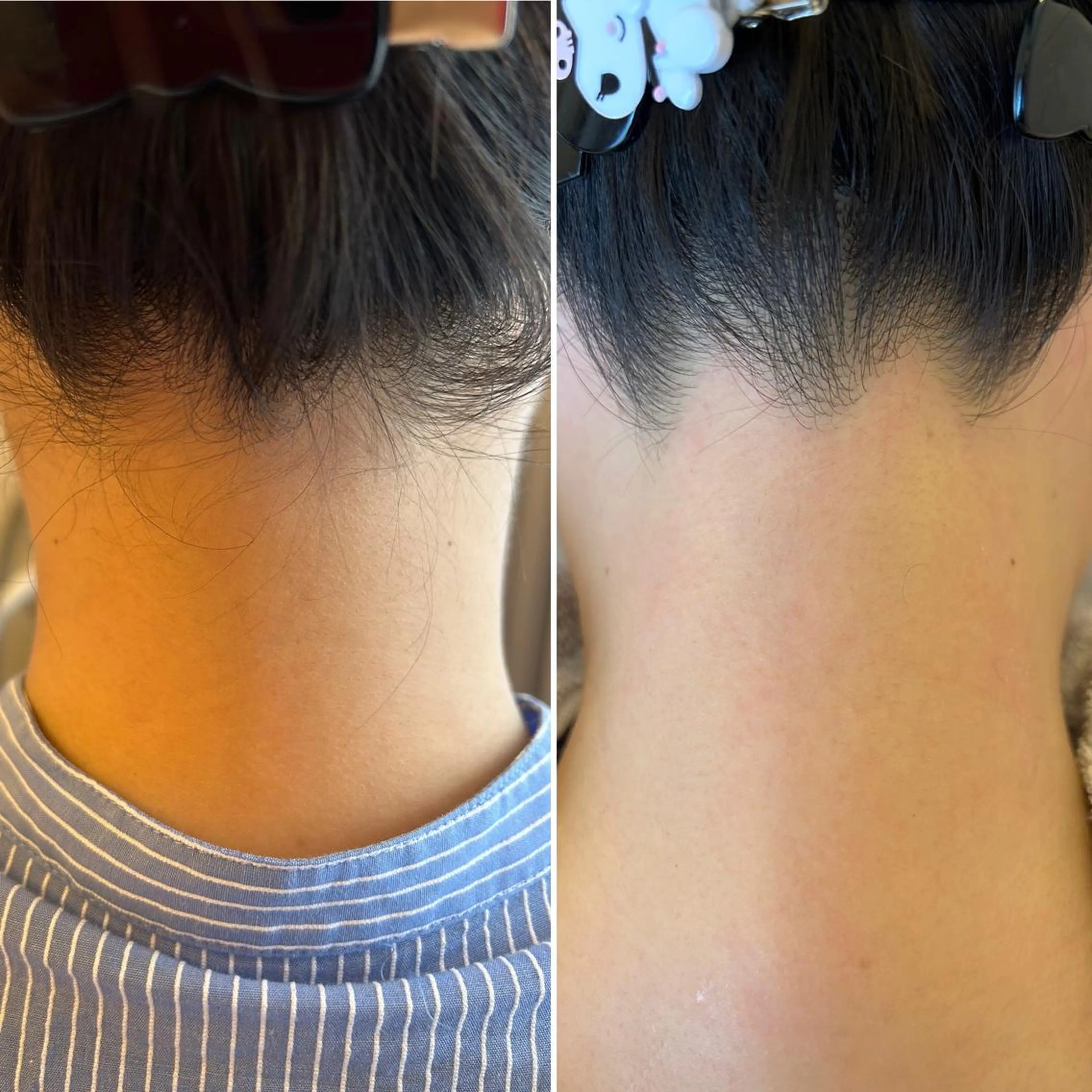 アイブロウ 眉毛ワックス脱毛 ワックス脱毛🌈 ESPOIRnocoのエステ・リラクイメージ