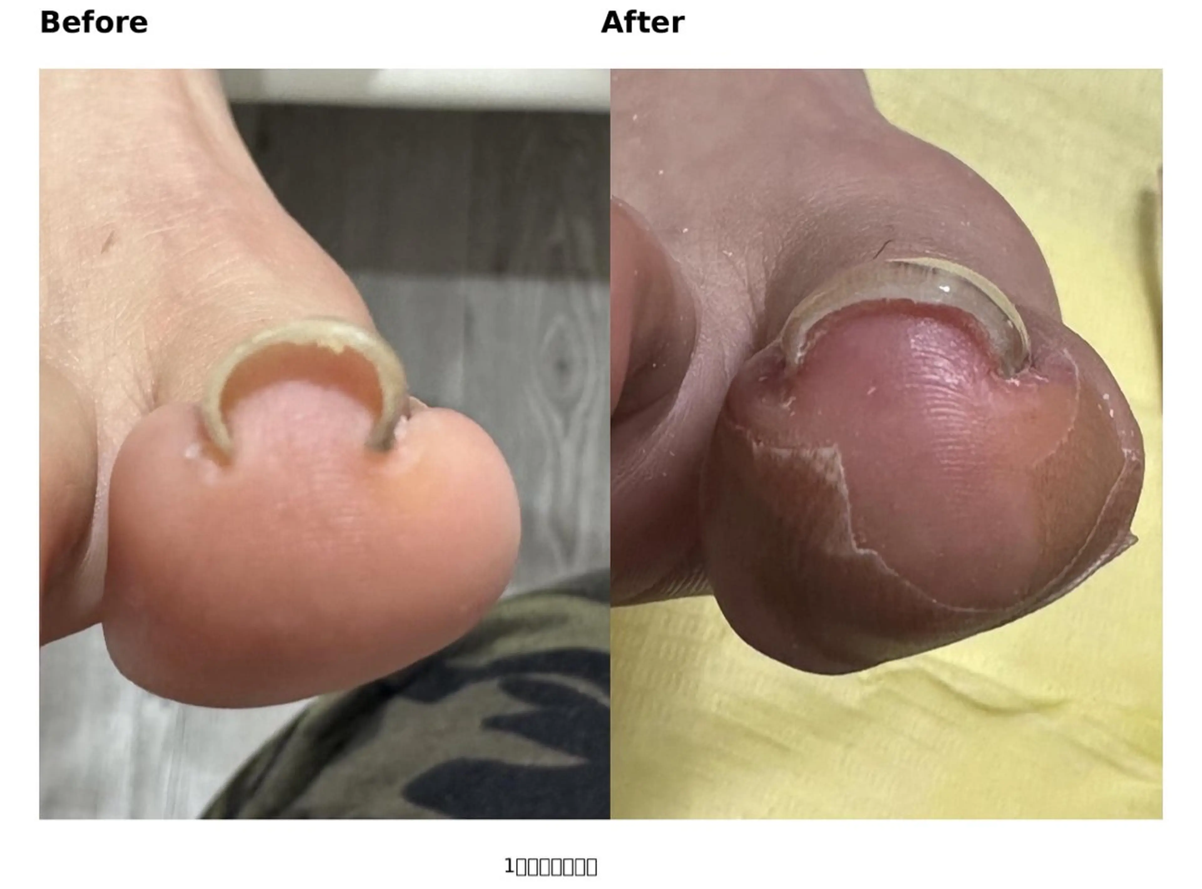 ネイル フットネイル Nail salon Modeのネイルデザイン