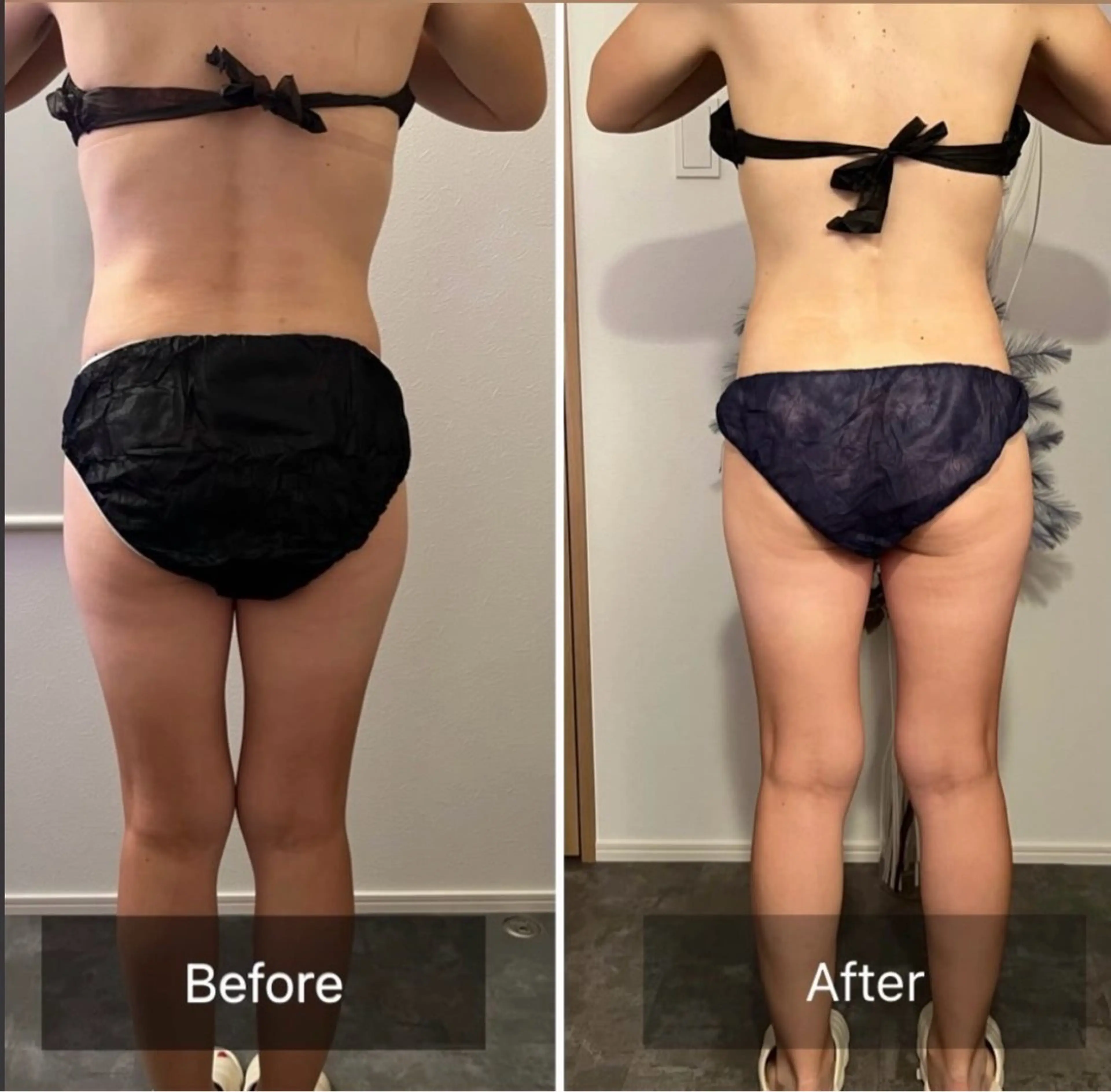 A.所属・Raviy(A.) 【痩身・韓国肌管理】のエステ・リラクイメージ