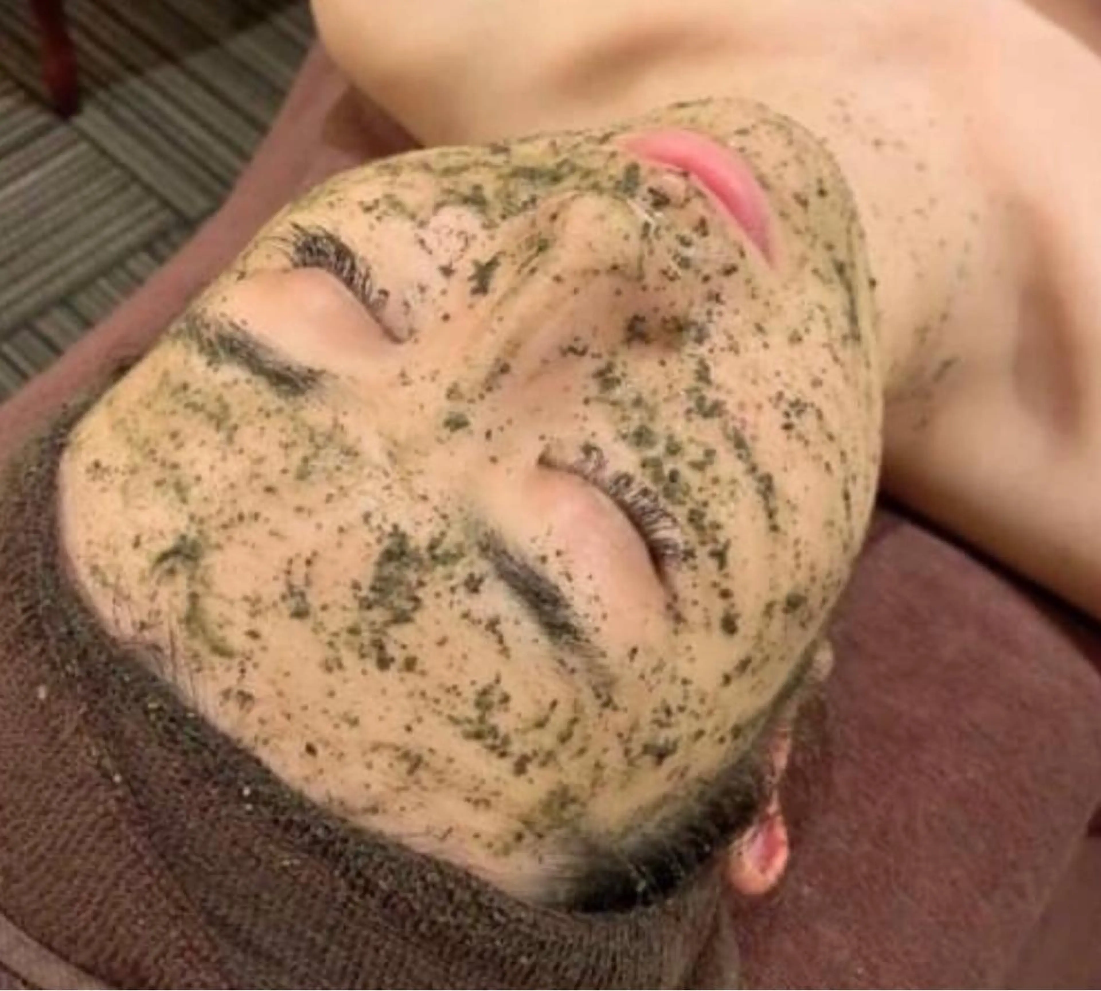 【迷ったらコレ！悩み解決☆】剥離なしダウンタイムなしハーブピーリングREVI陶肌トリートメント オプション3つプレゼントの写真