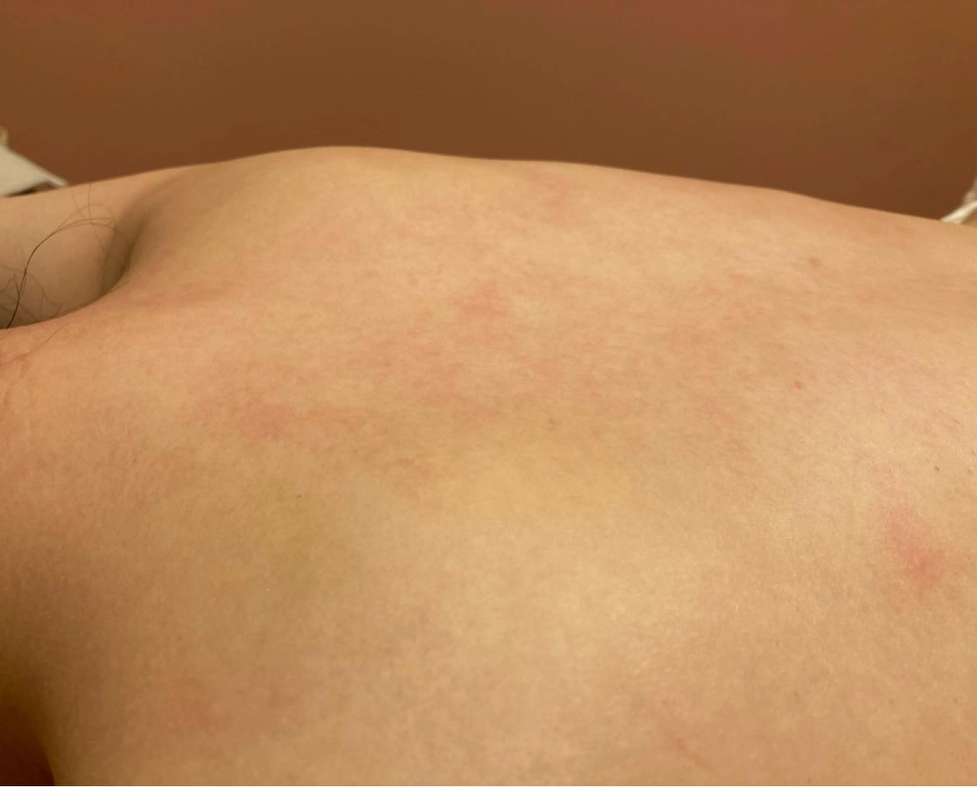 脱毛 根岸 未波のエステ・リラクイメージ