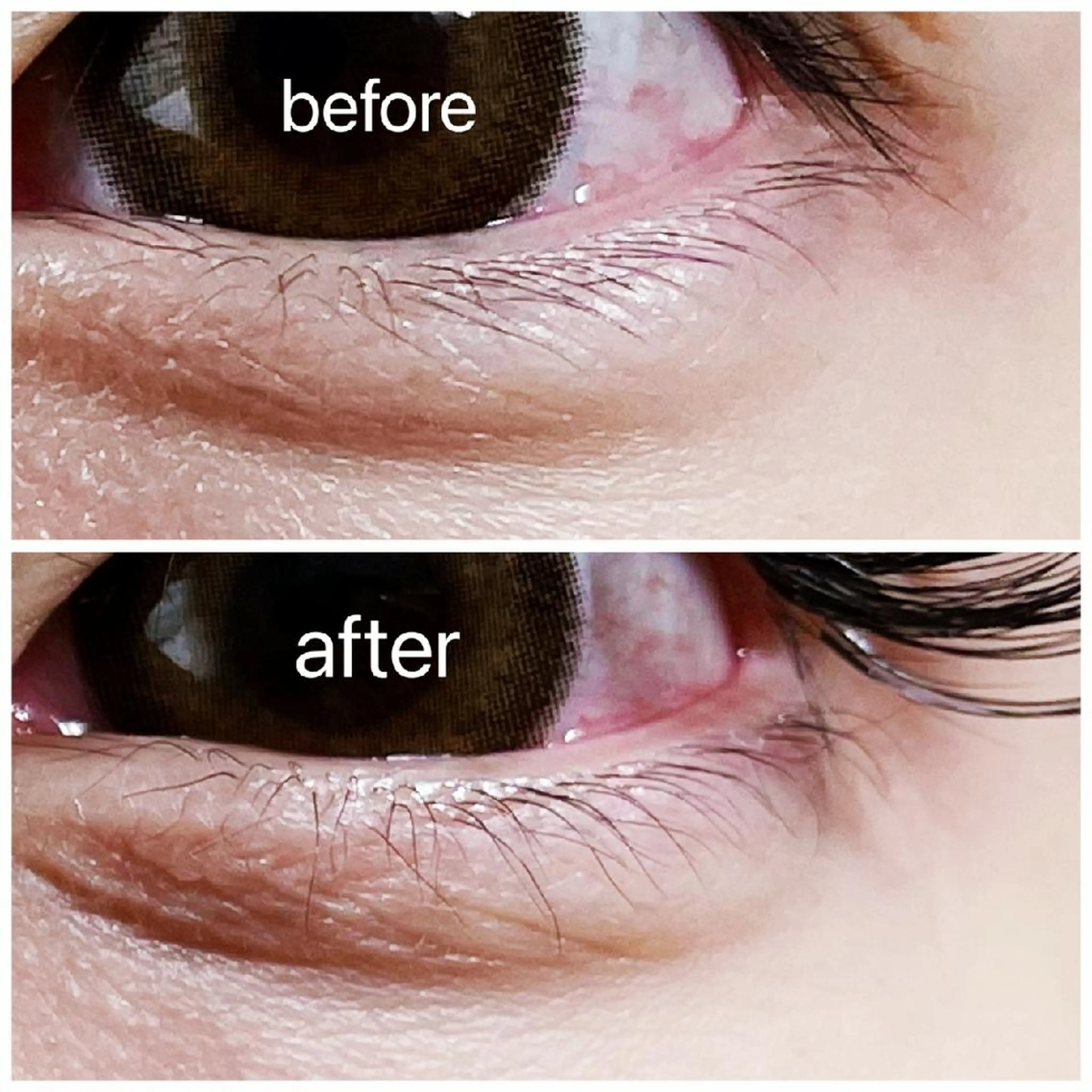 下まつ毛パーマの写真