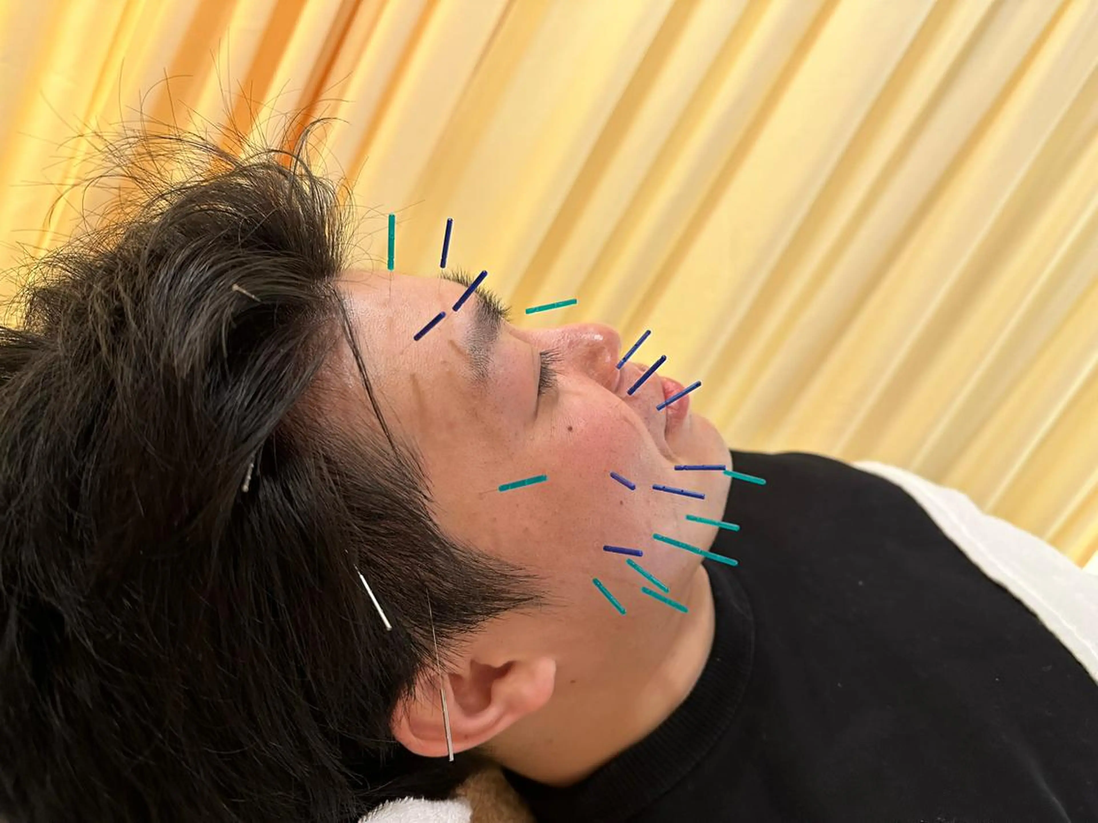 その他 BBB3(ビースリー)所属・鍼灸サロン BBB3のその他イメージ