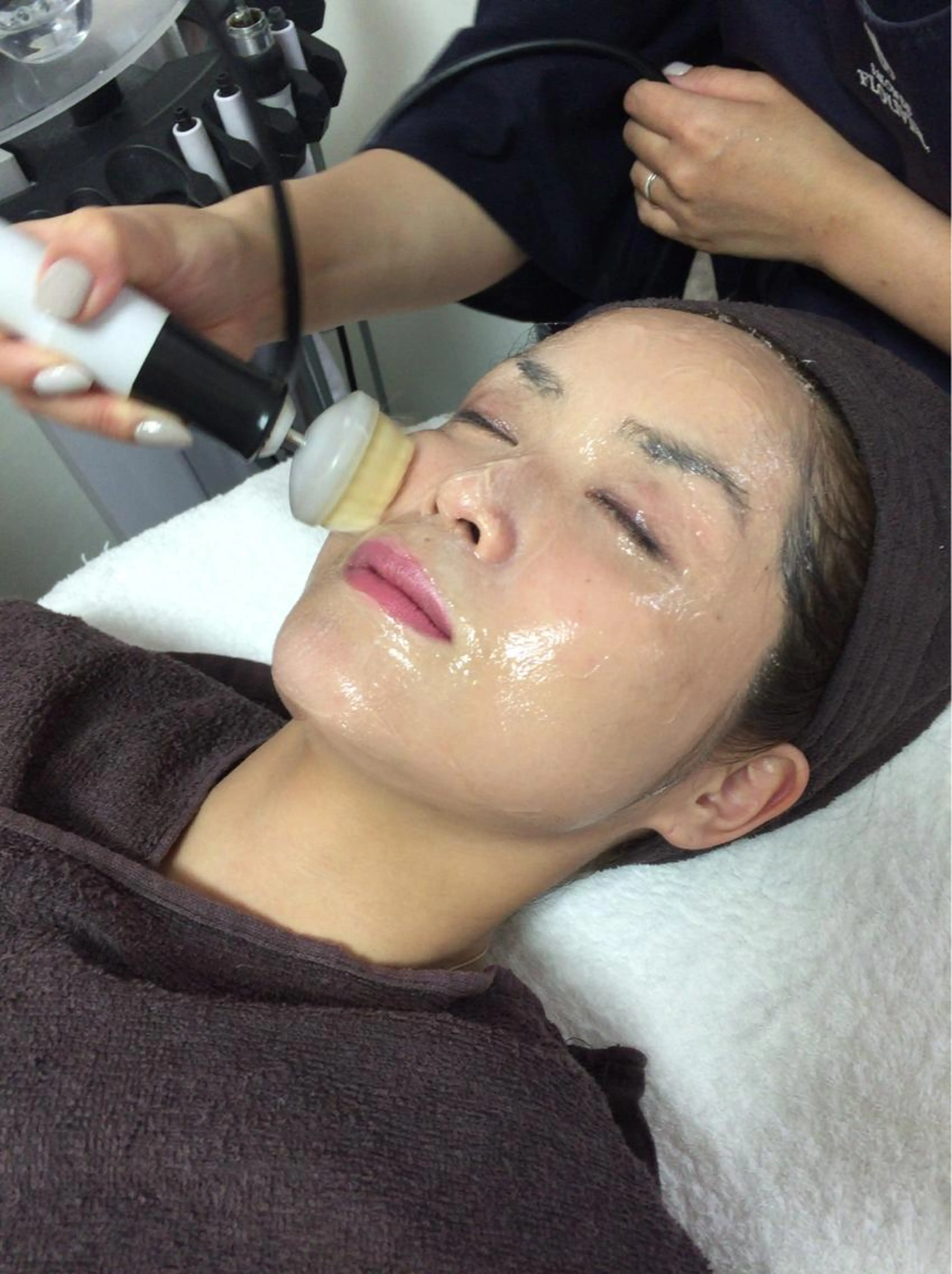 最強！小顔♡リフトアップマシーンNARLフェイシャルエステフルコースの写真