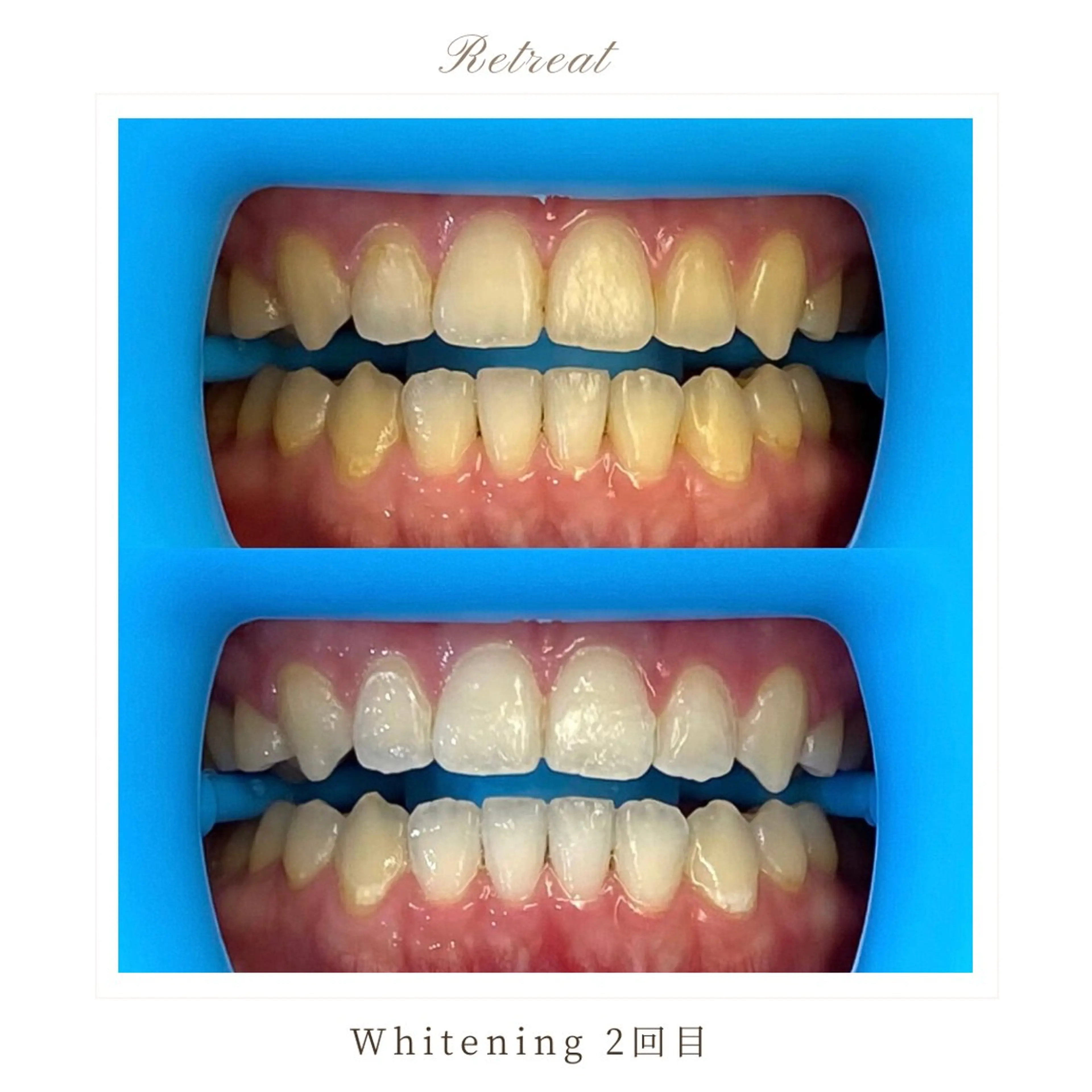 歯科医院提携 Retreatのエステ・リラクイメージ