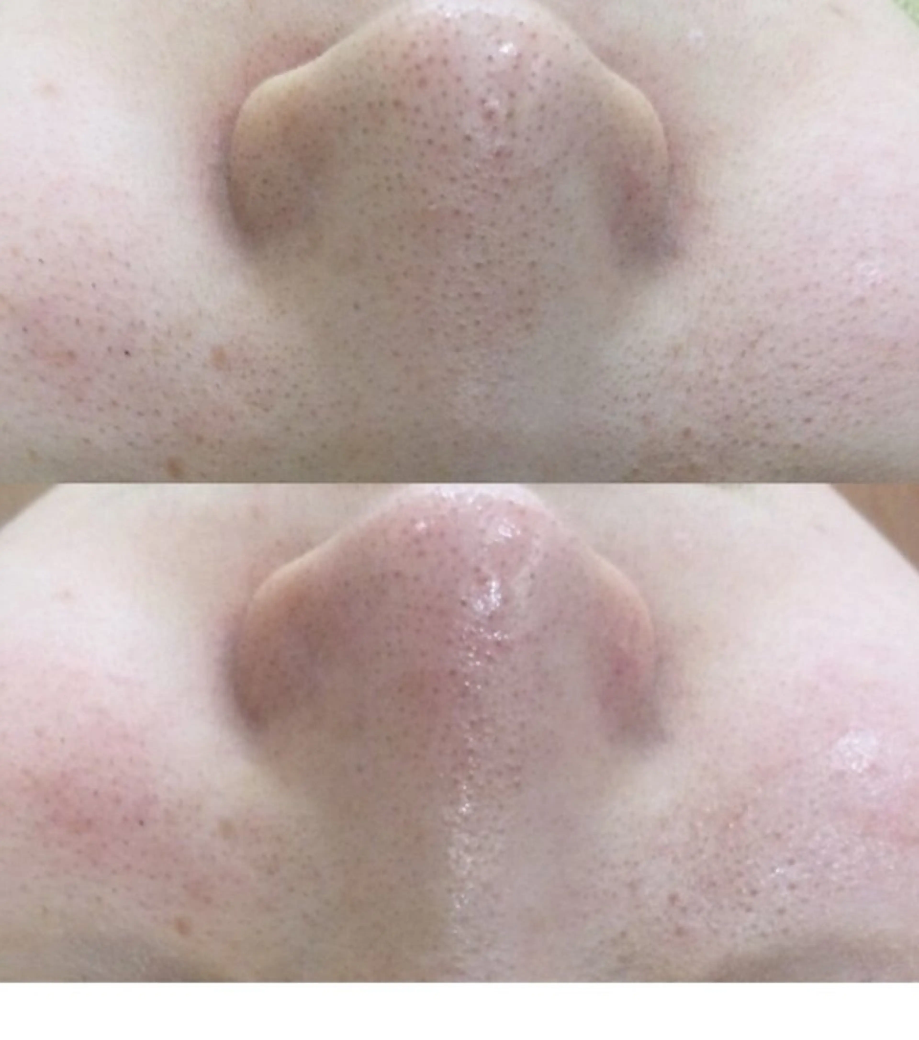 ファッショニスタ AIのエステ・リラクイメージ