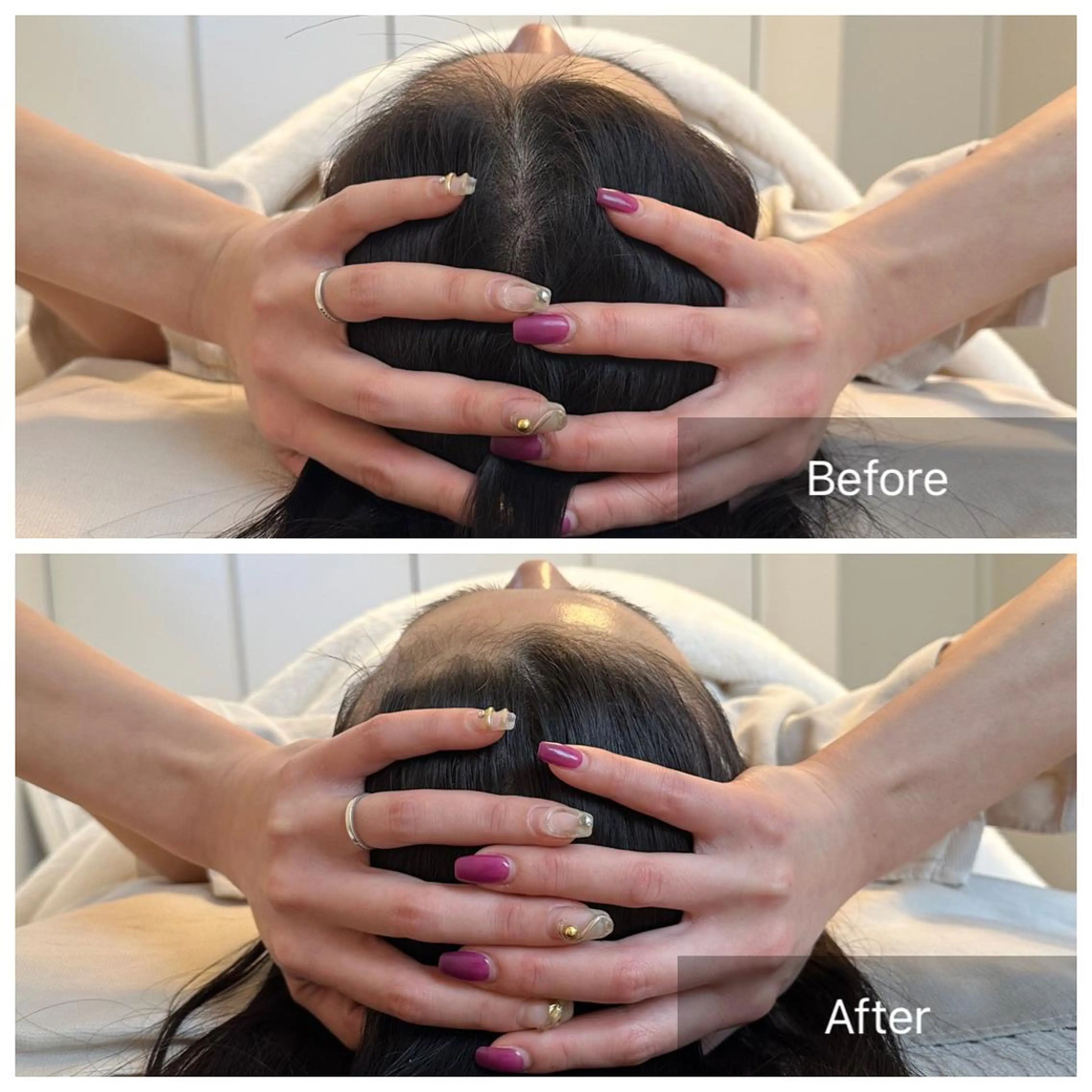 ◆1番人気◆脳洗浄小顔調整ベーシック100分の写真