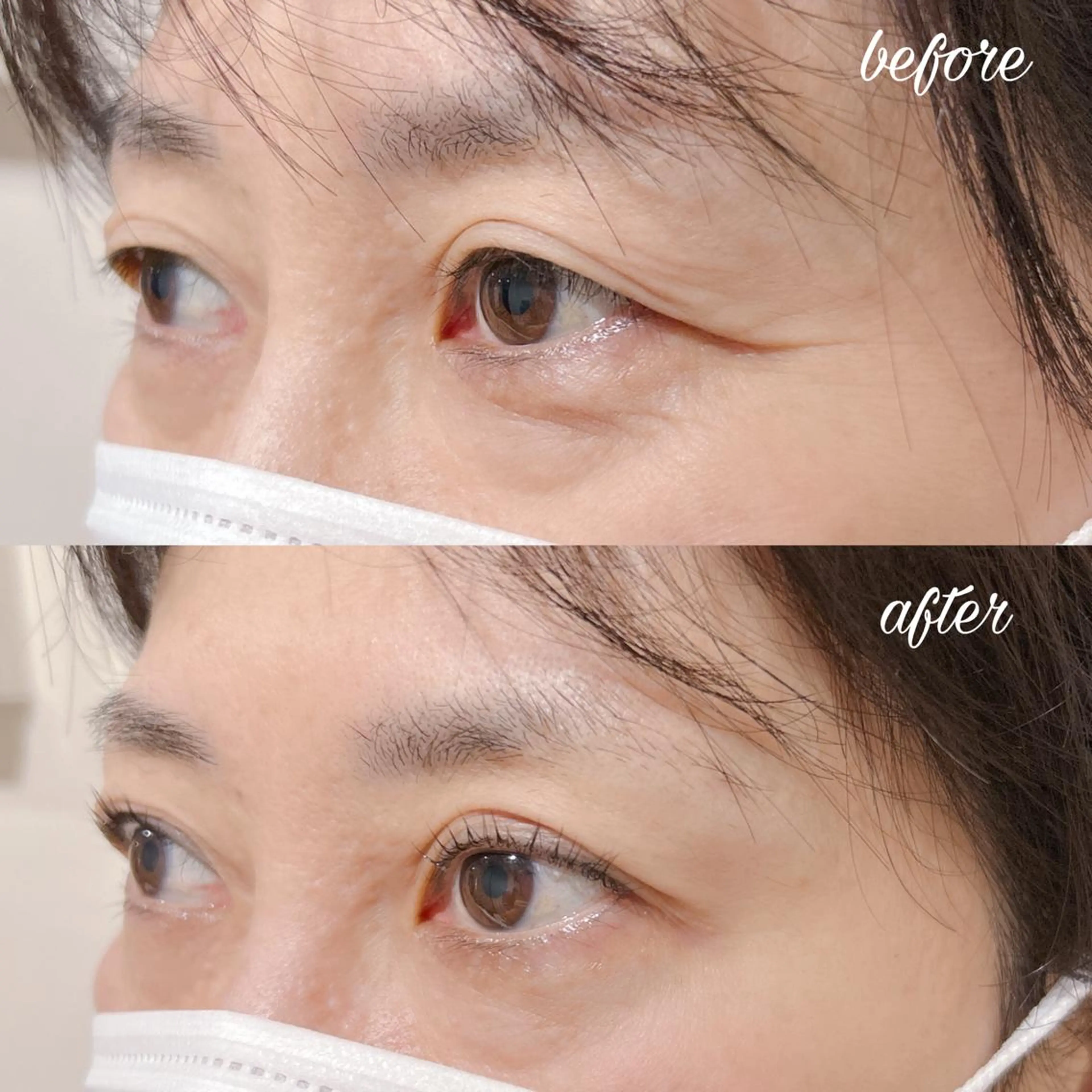 マツエク・マツパ マツパ merveilles所属・まつげ/整体/にきび ・アトピー専門サロンのマツエク・マツパデザイン