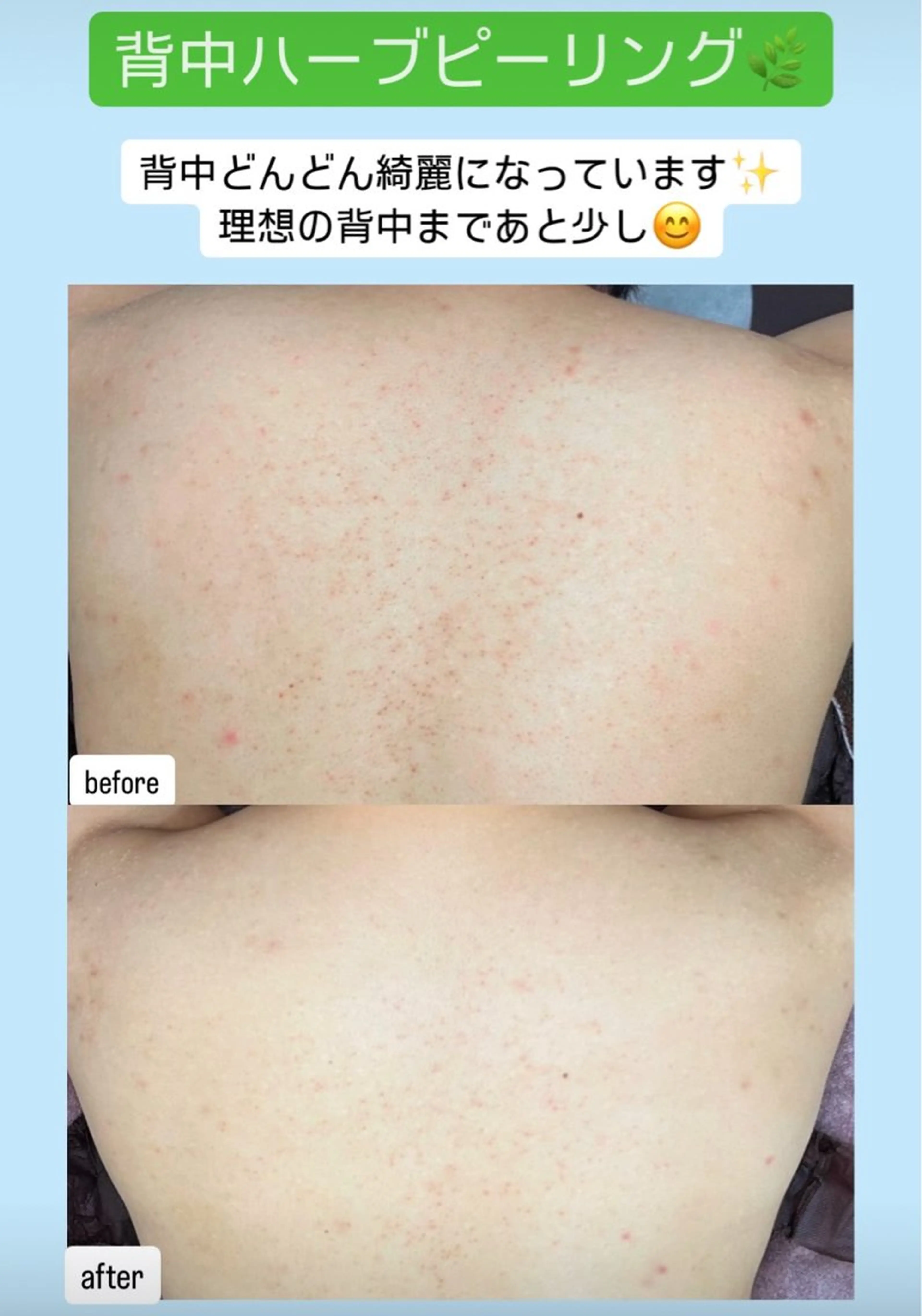 エステ ベラージュ【美背中・ 美尻・フェイシャル】のエステ・リラクイメージ