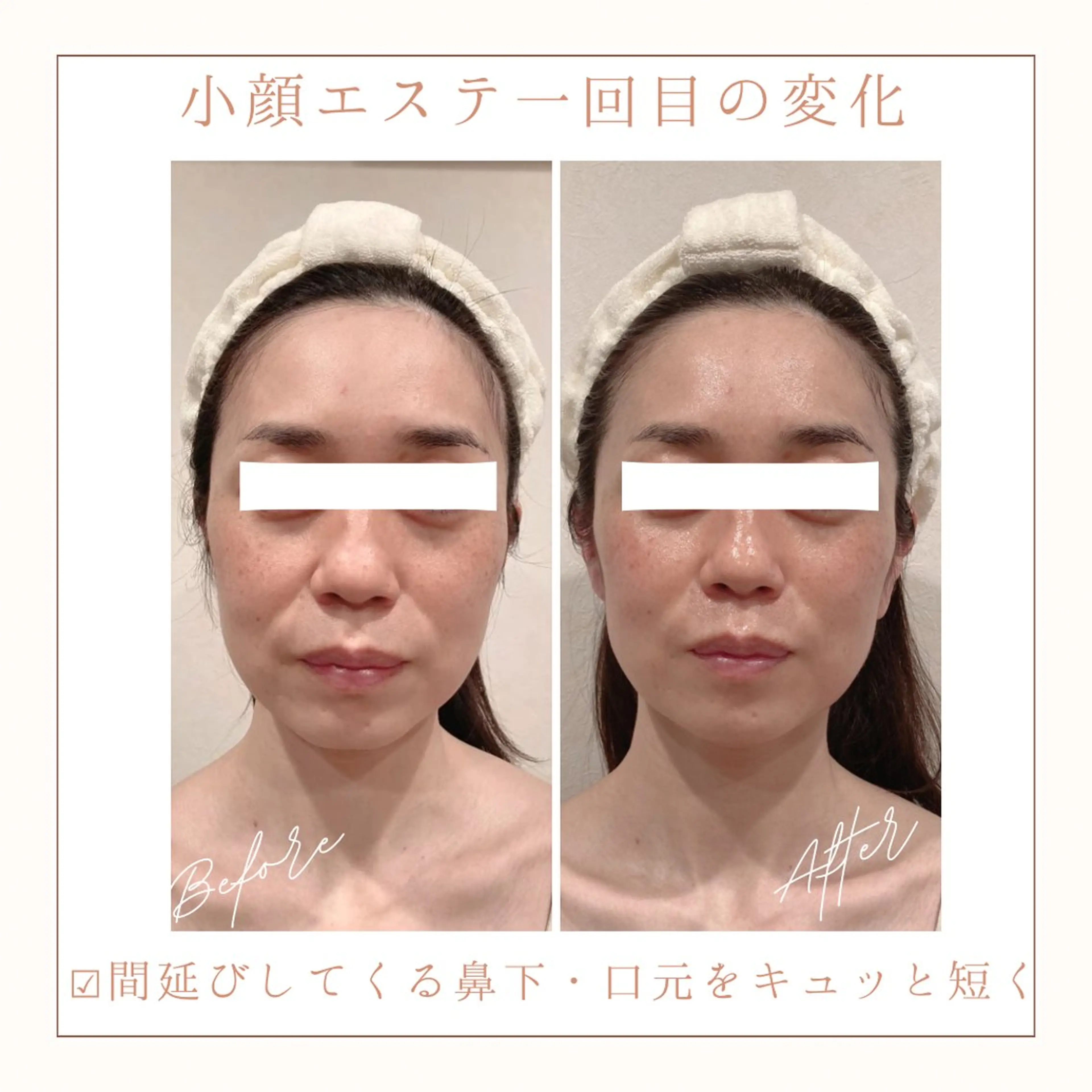 エステ リラク 小顔×肌質改善サロン soin〔ソワン〕のエステ・リラクイメージ