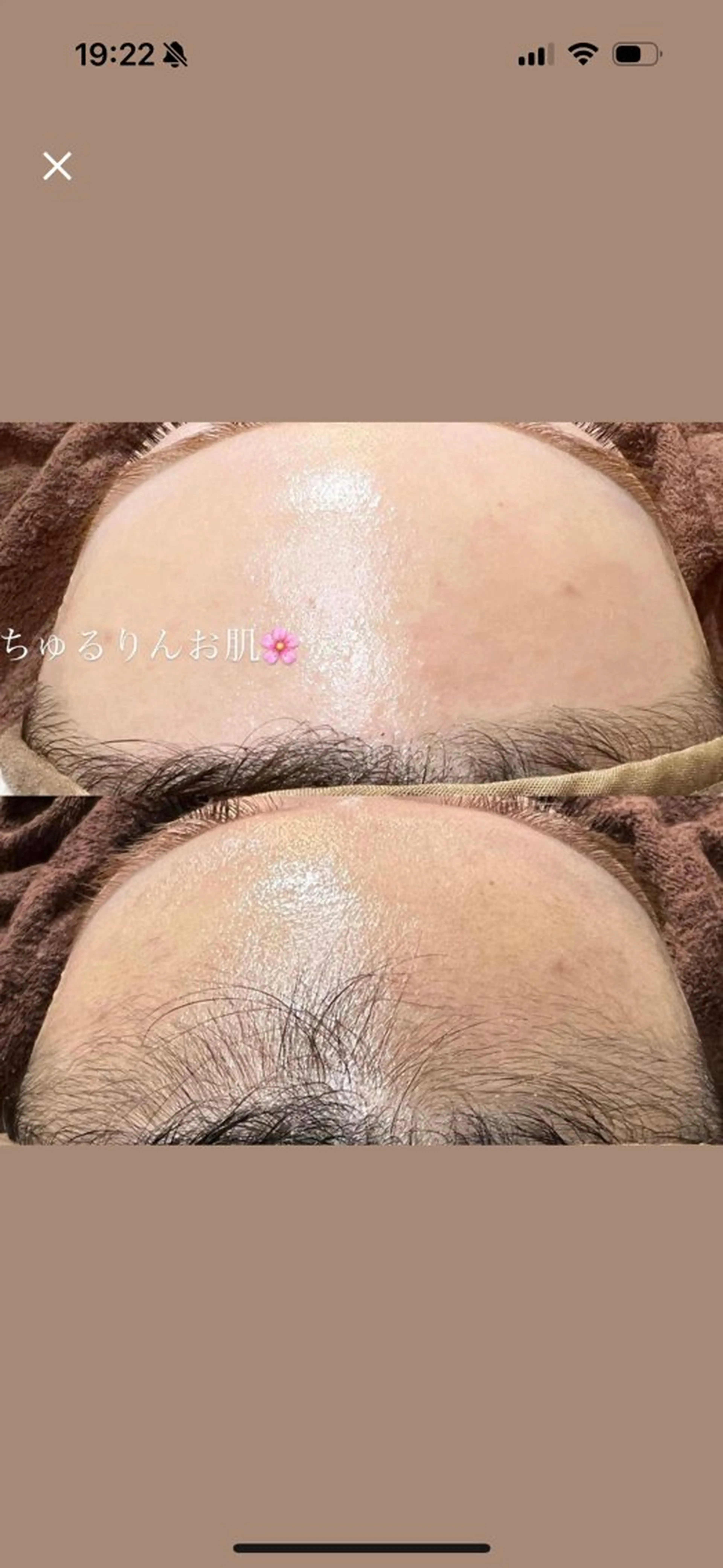 ワックス脱毛/光脱毛 🎀新宿駅徒歩5分のエステ・リラクイメージ