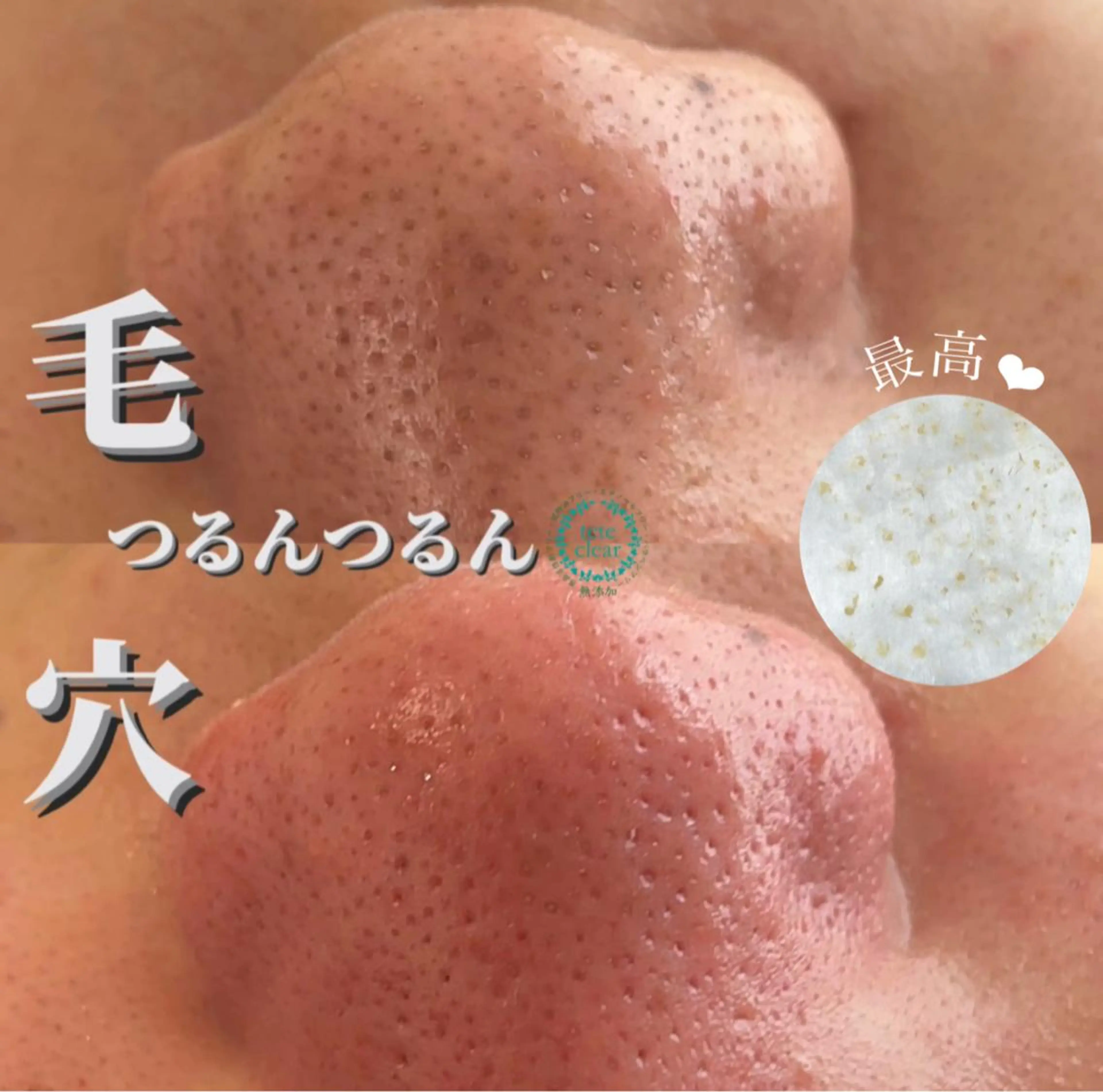 毛穴/シミ肝斑/脱毛 横山梨里のエステ・リラクイメージ