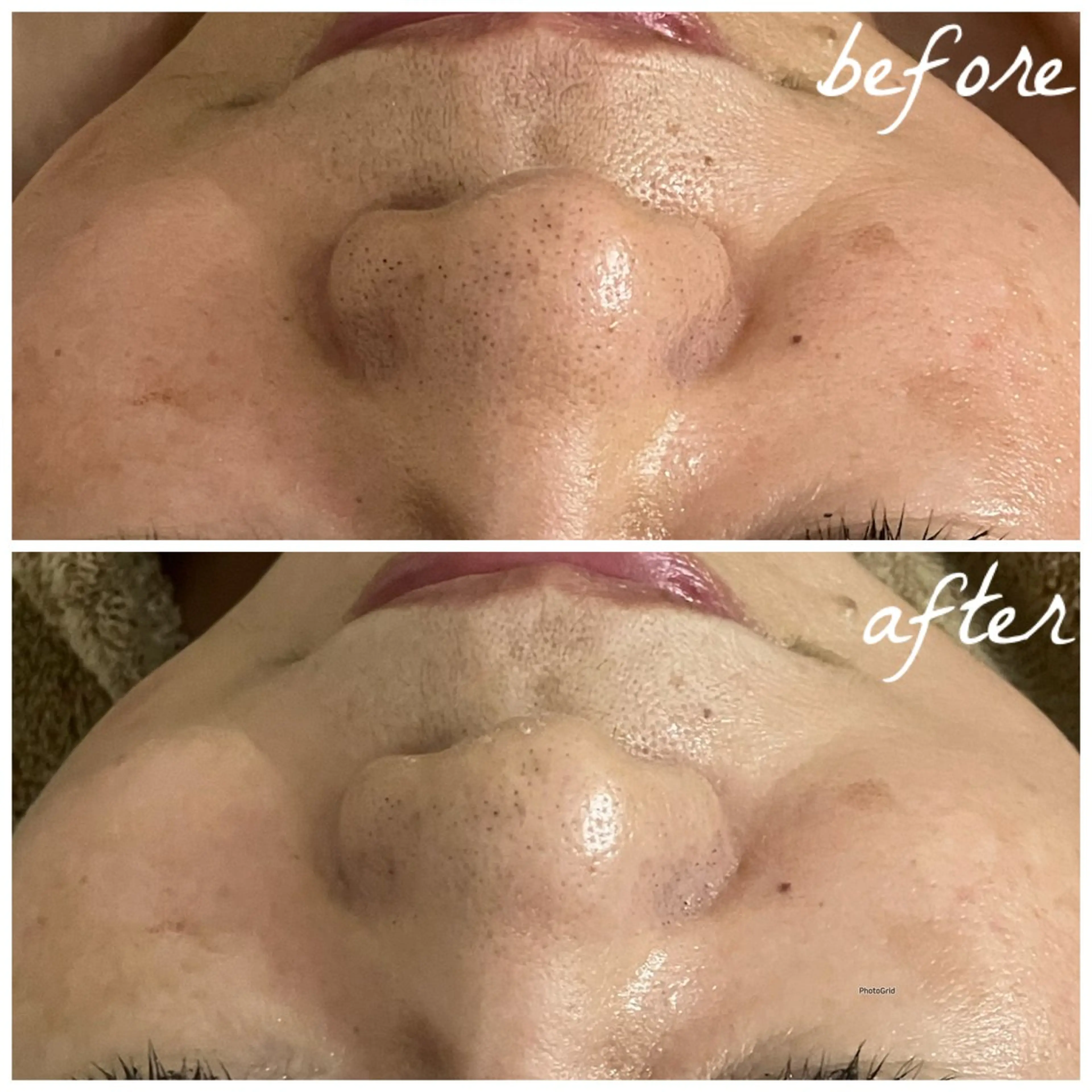 メンズ エステ メナード岐阜茜部 杉浦のエステ・リラクイメージ