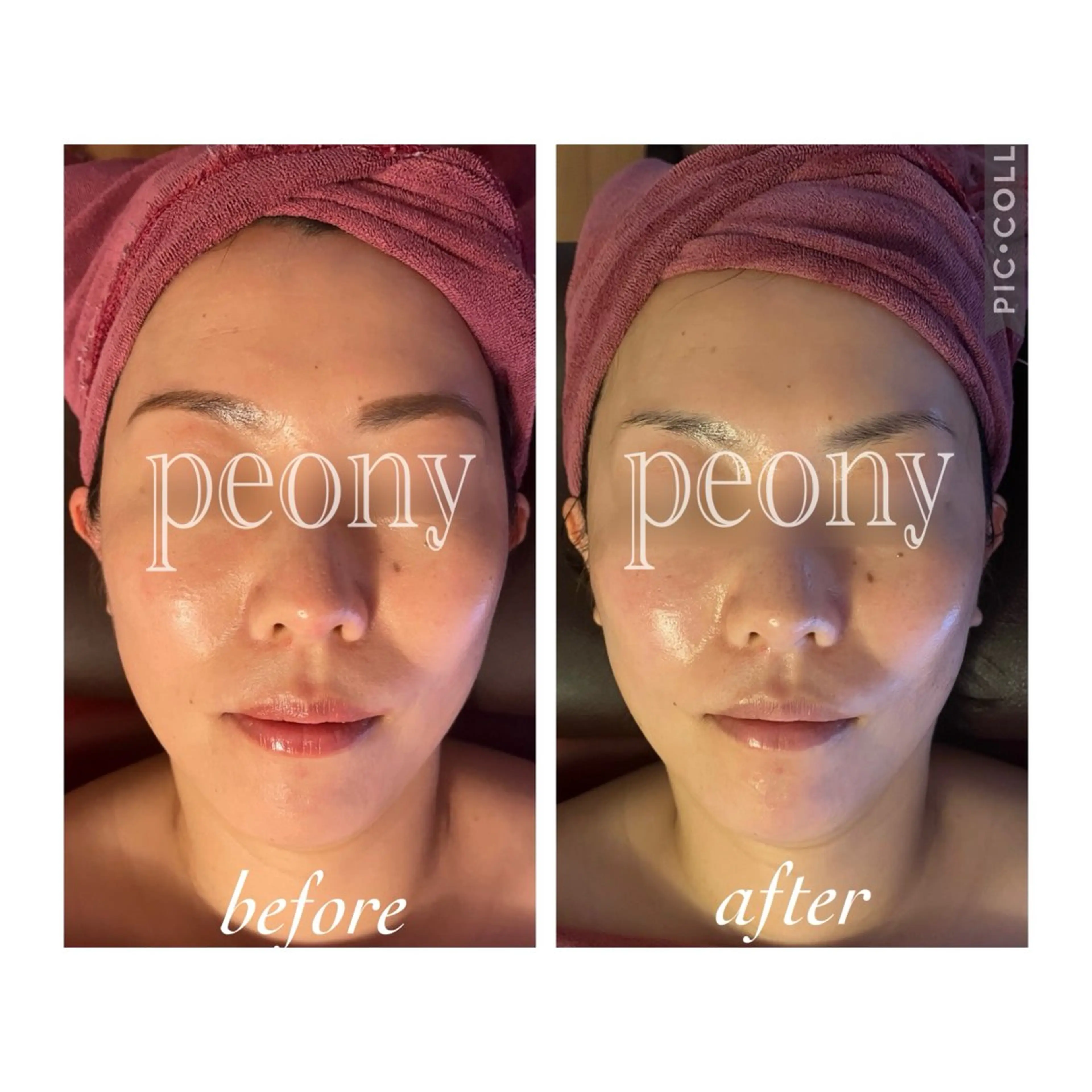 デトックス美容専門サロンpeony所属・デトックス美容専門 サロンpeonyのエステ・リラクイメージ