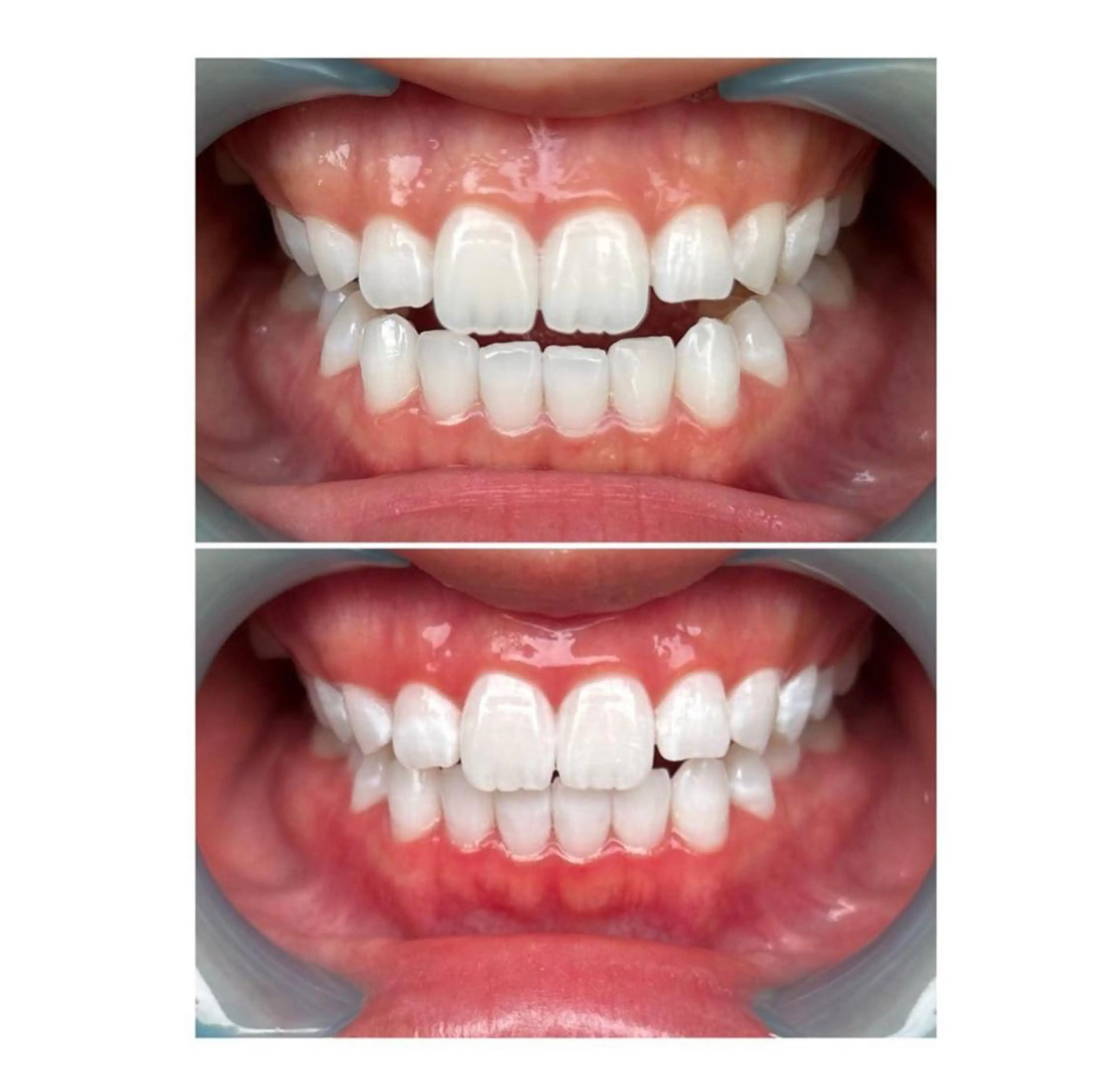 エステ ホワイトニングジム 池袋のその他イメージ