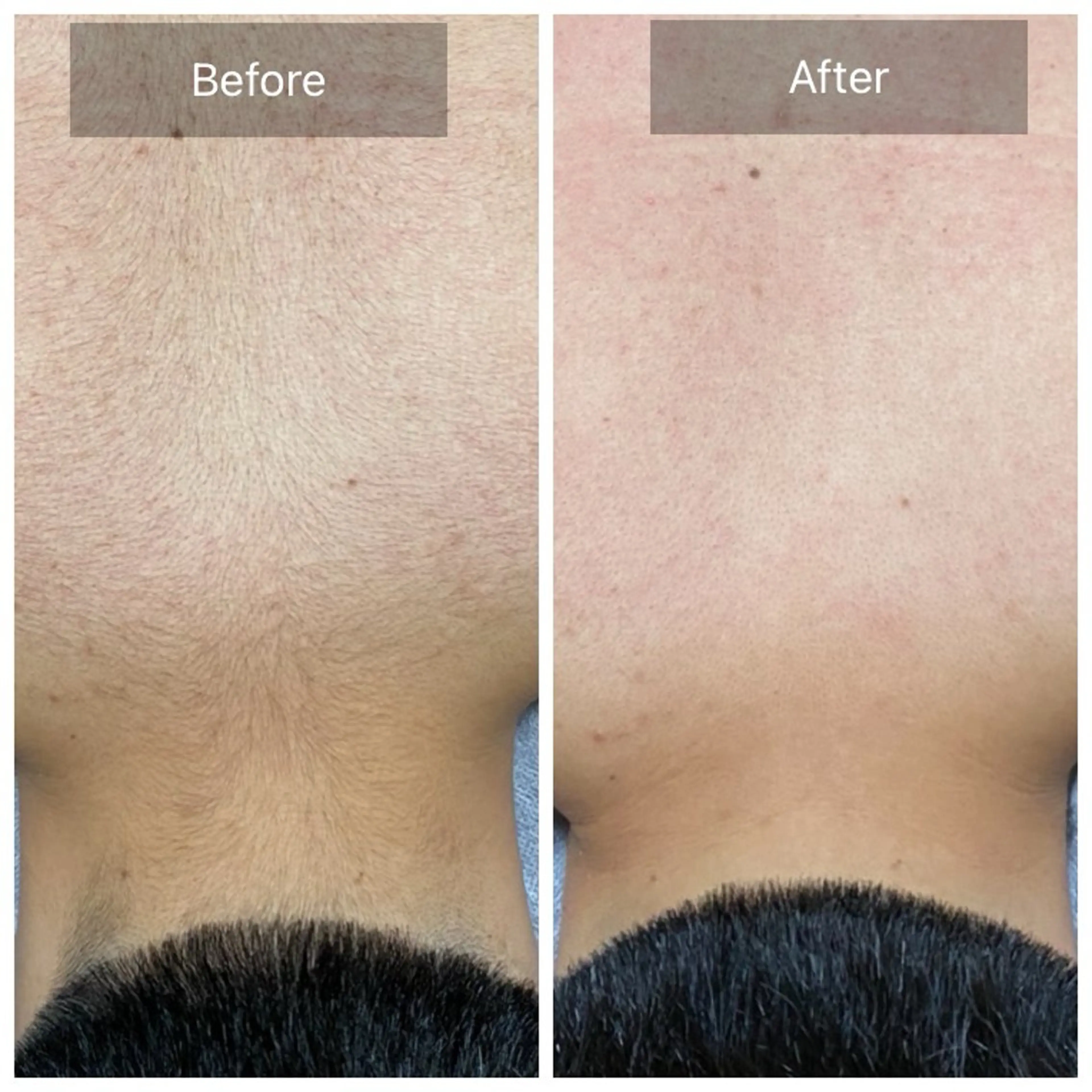 脱毛 Beauty Studio NICO25所属・ビューティースタジオ NICO25のその他イメージ