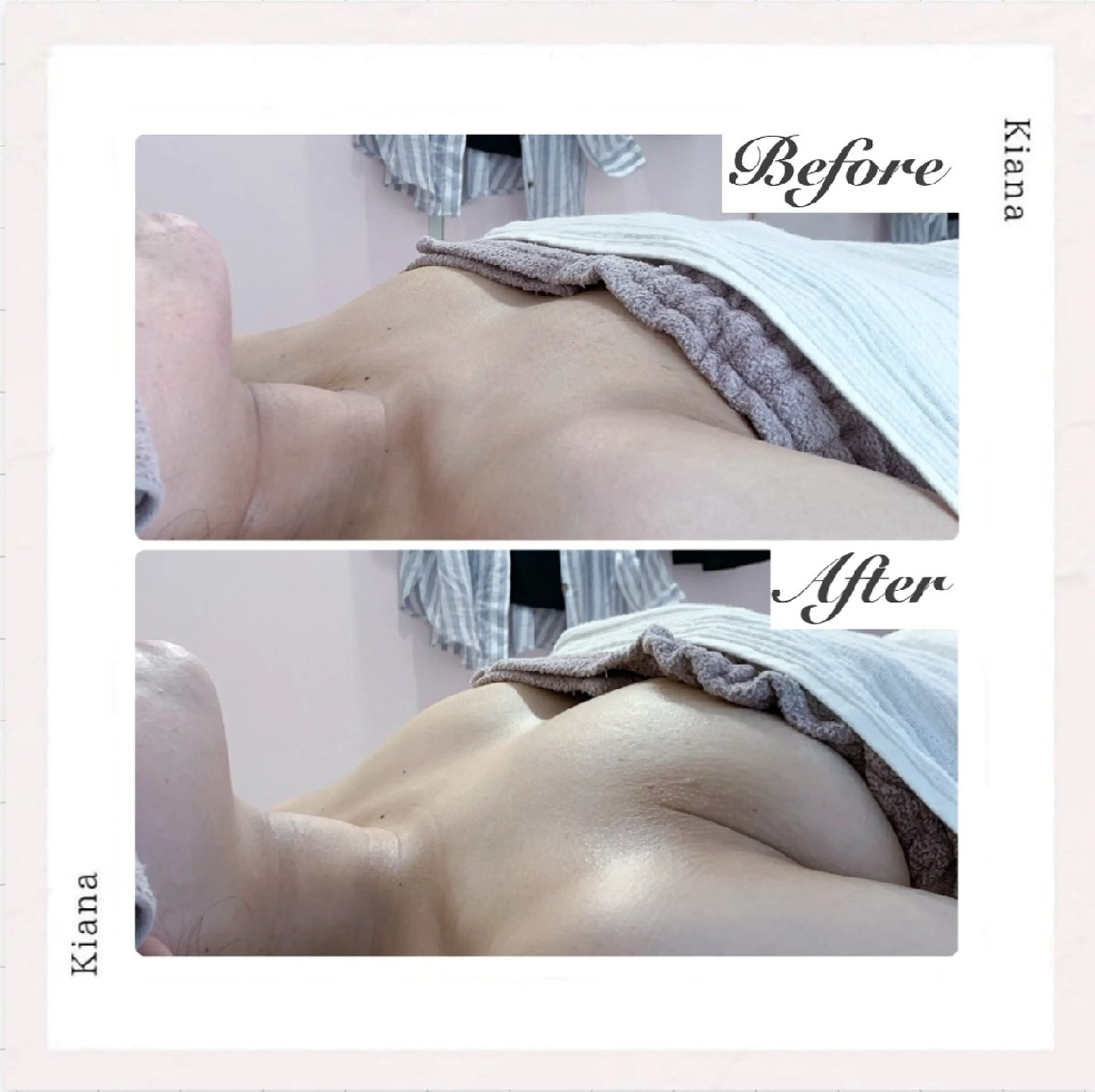 エステ リラク 【バスト専門店 】 Kiana のエステ・リラクイメージ