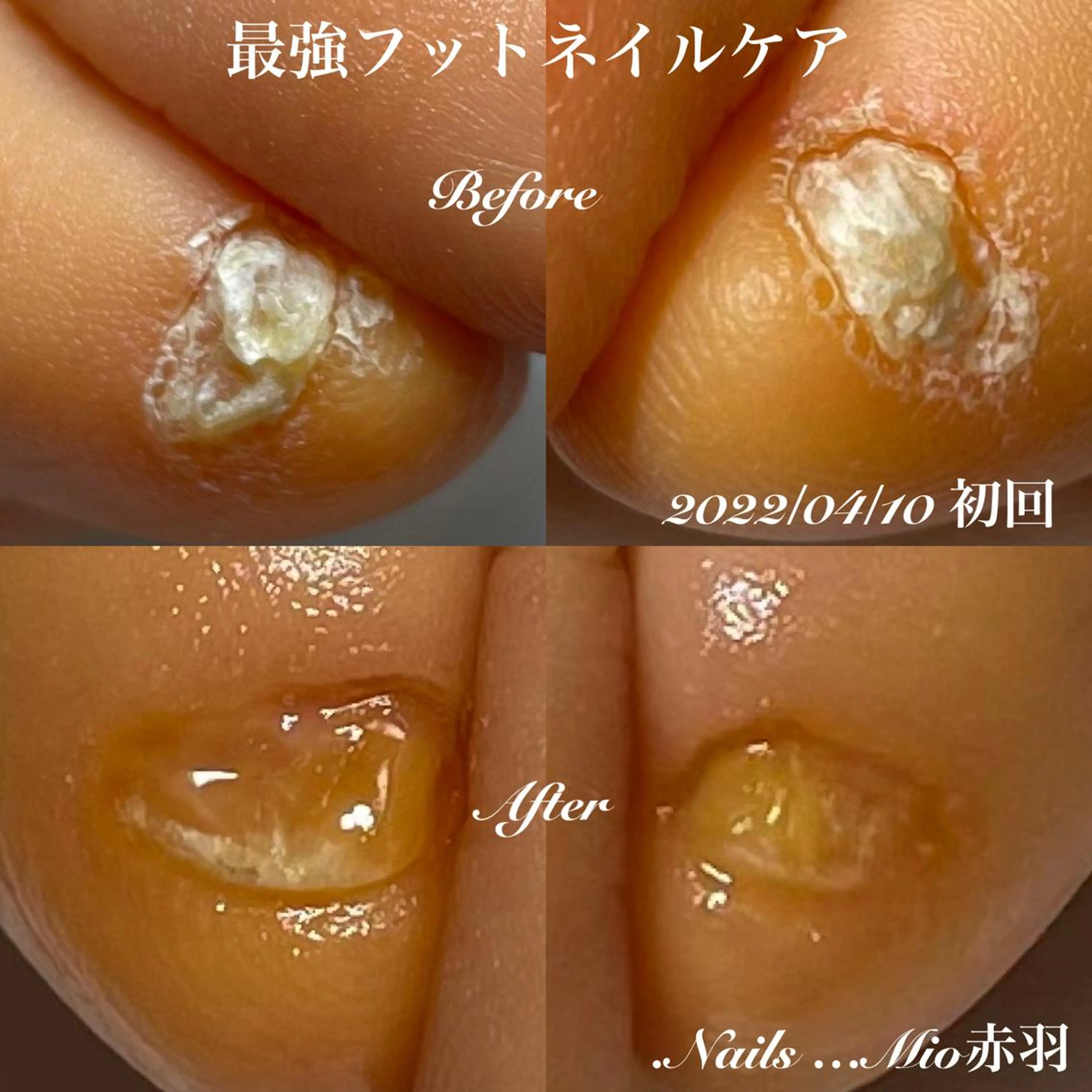 ネイル フットネイル .Nails Mio 赤羽西ネイルサロンのネイルデザイン