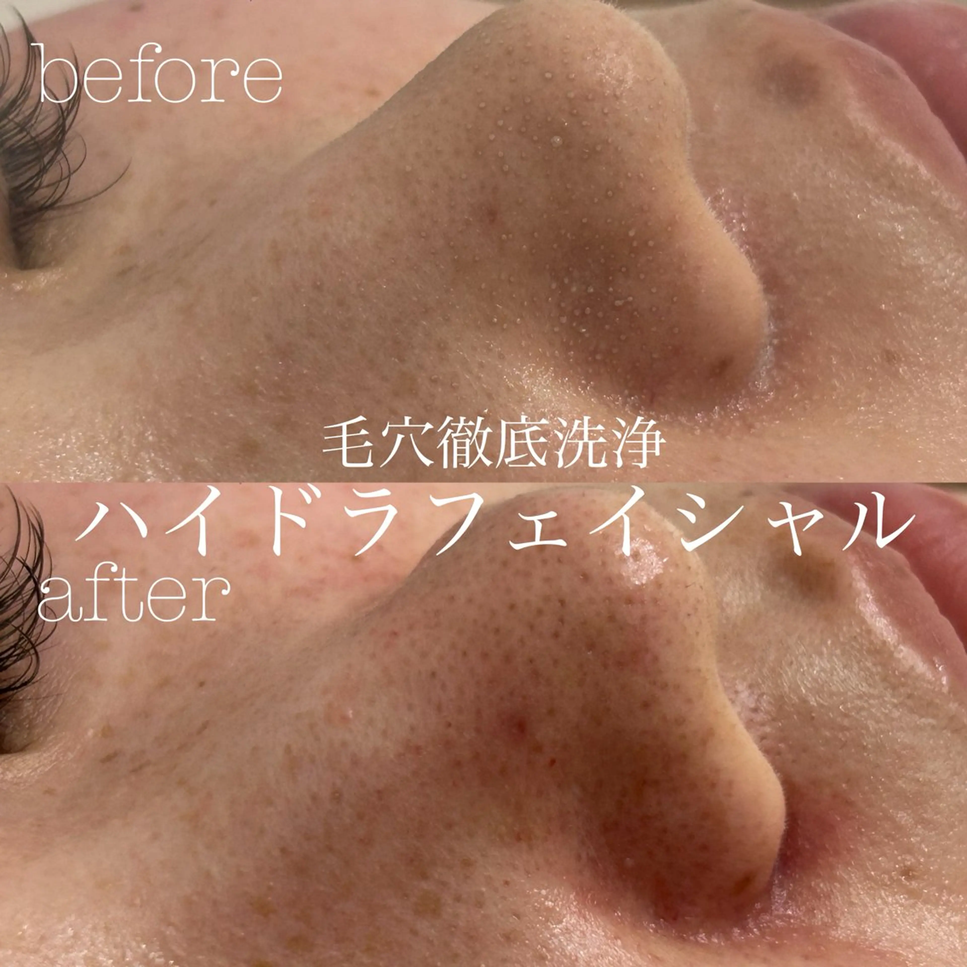 エステ フェイシャルサロン CHIARA 荒田のエステ・リラクイメージ